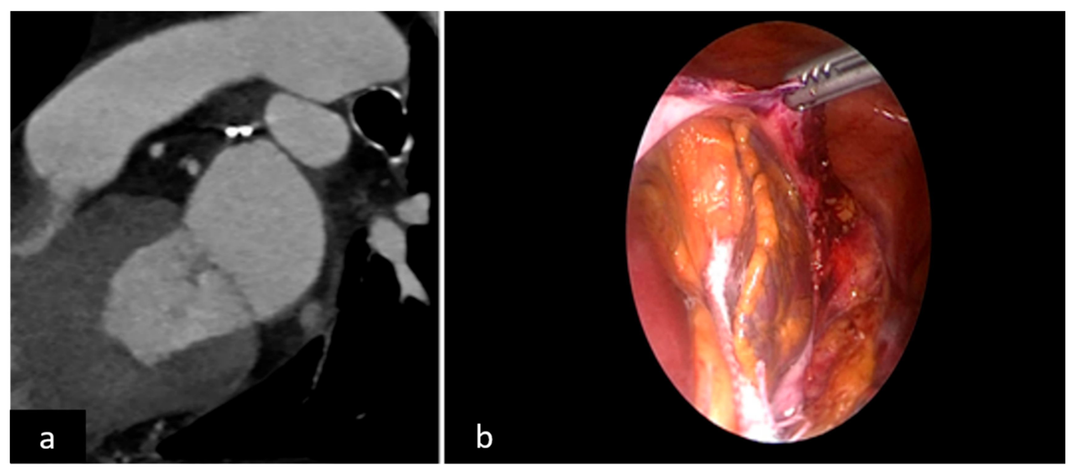 Jcm 11 00176 g003 Jcm 11 00176 g003