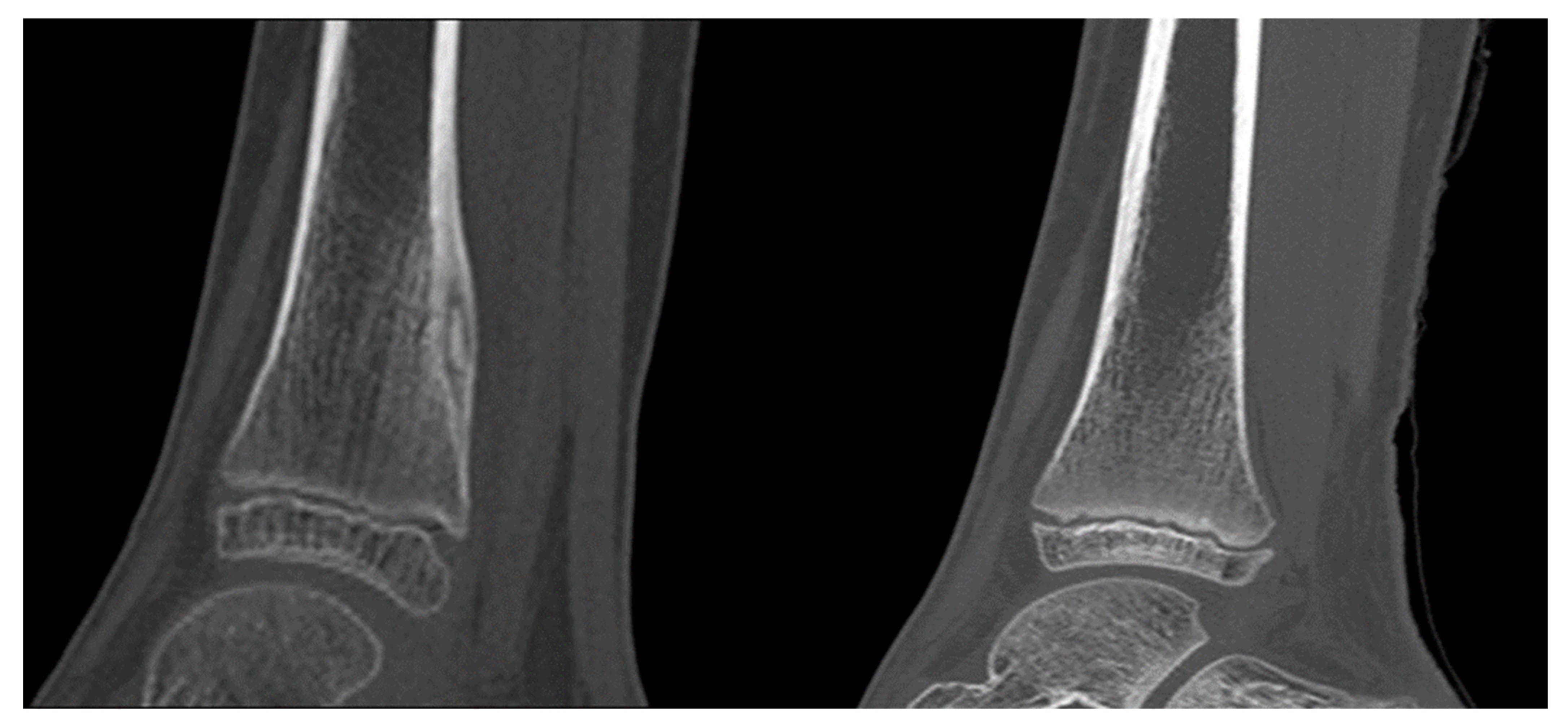 Jcm 11 00182 g005 Jcm 11 00182 g005