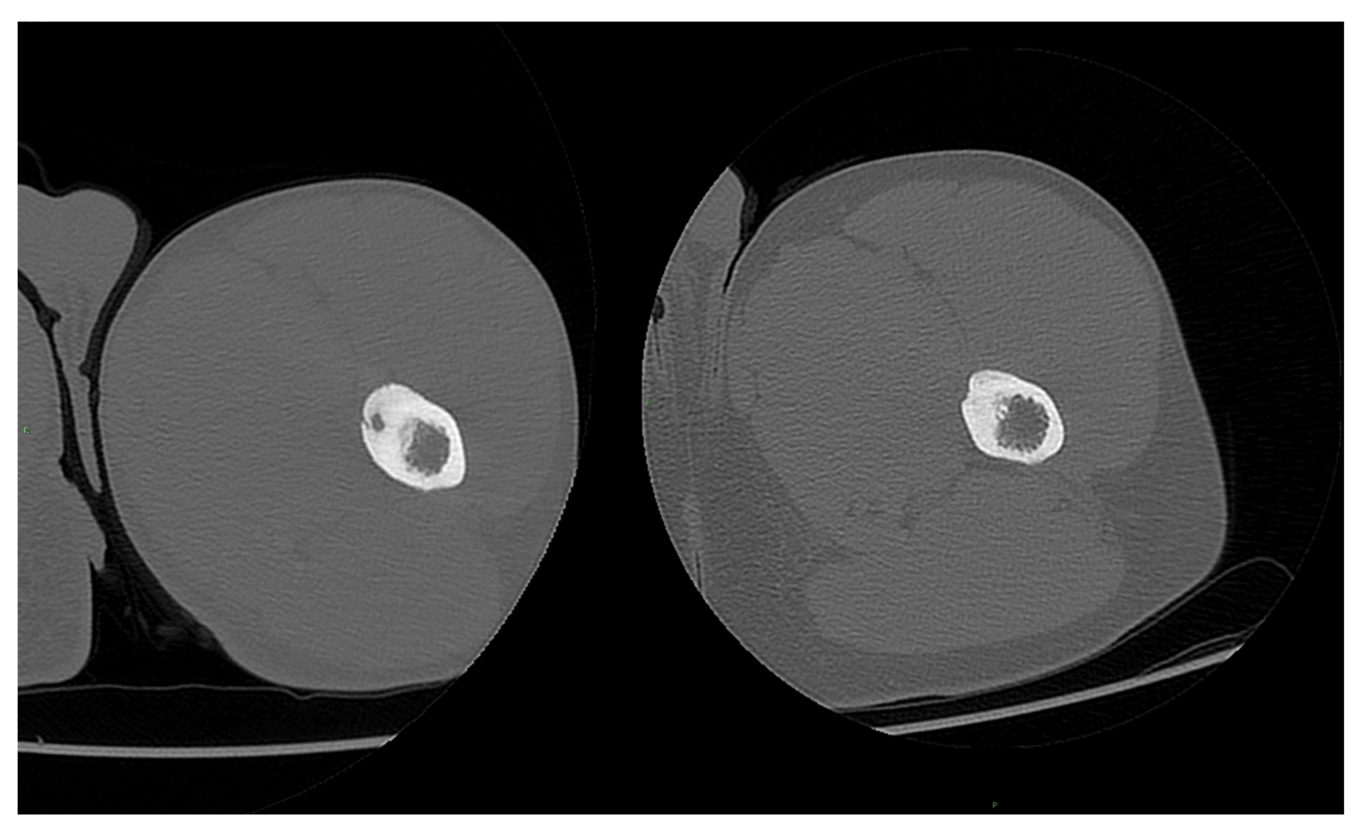 Jcm 11 00182 g007 Jcm 11 00182 g007