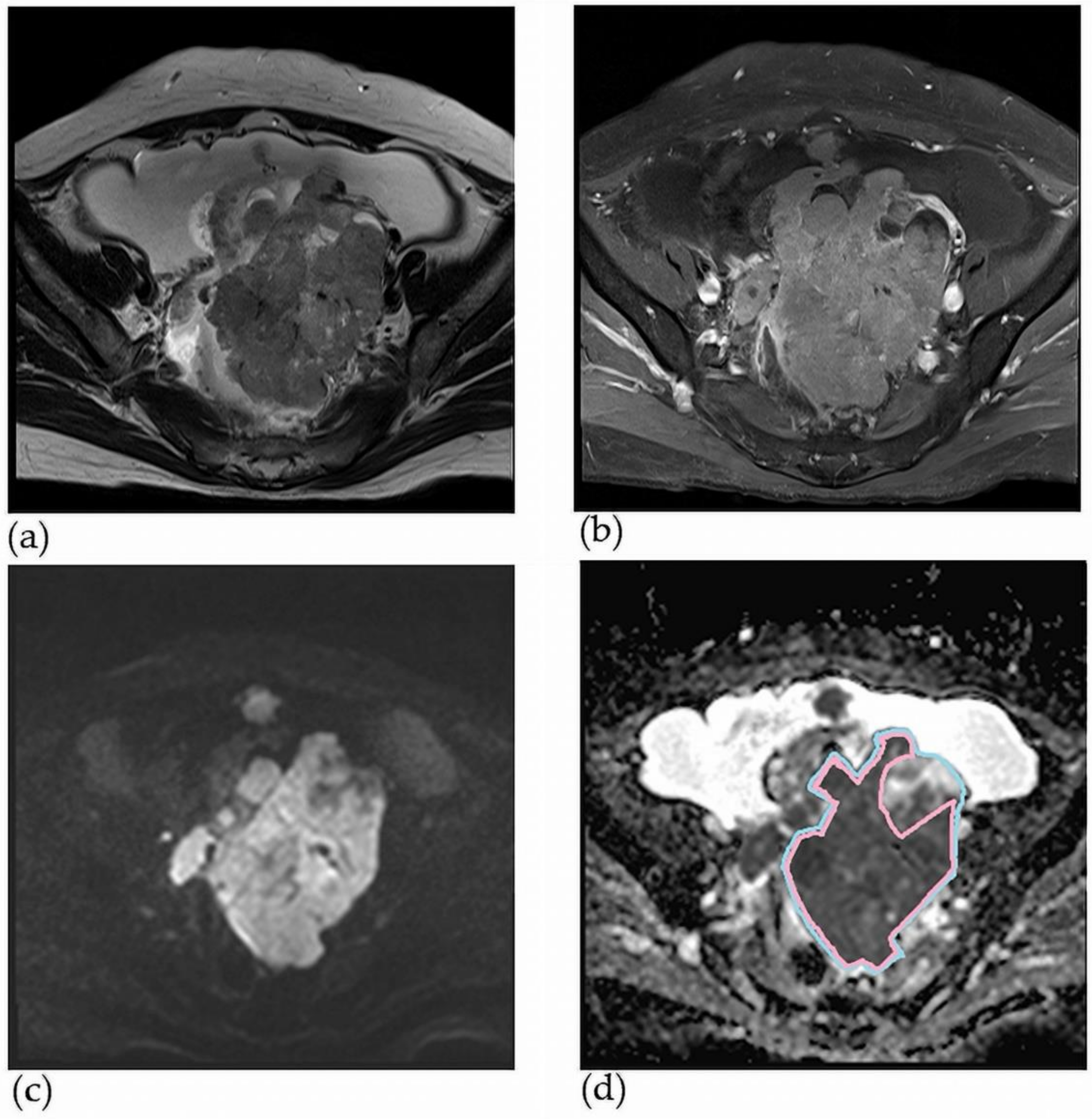 Jcm 11 00229 g002 Jcm 11 00229 g002