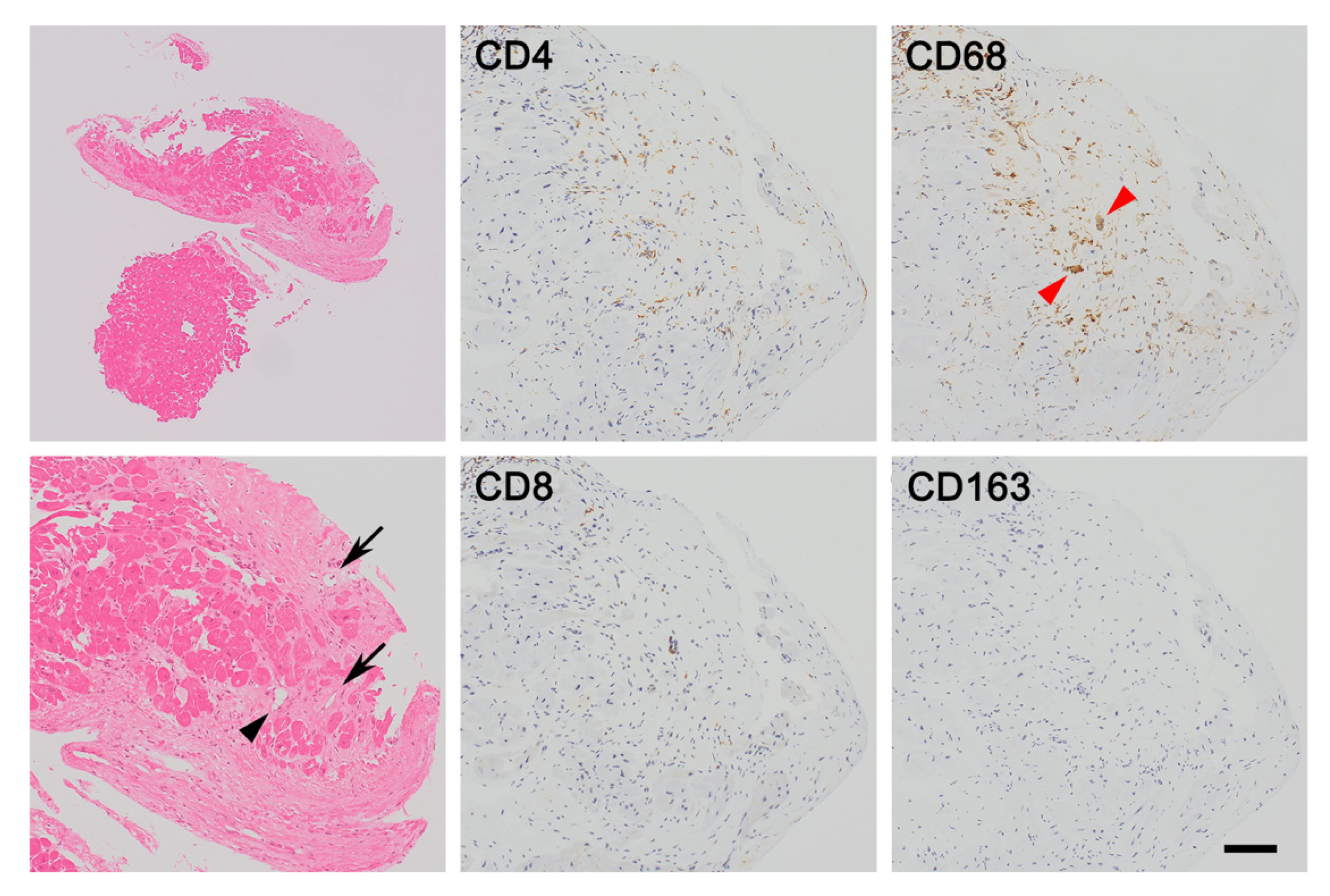 Jcm 11 00251 g002 550