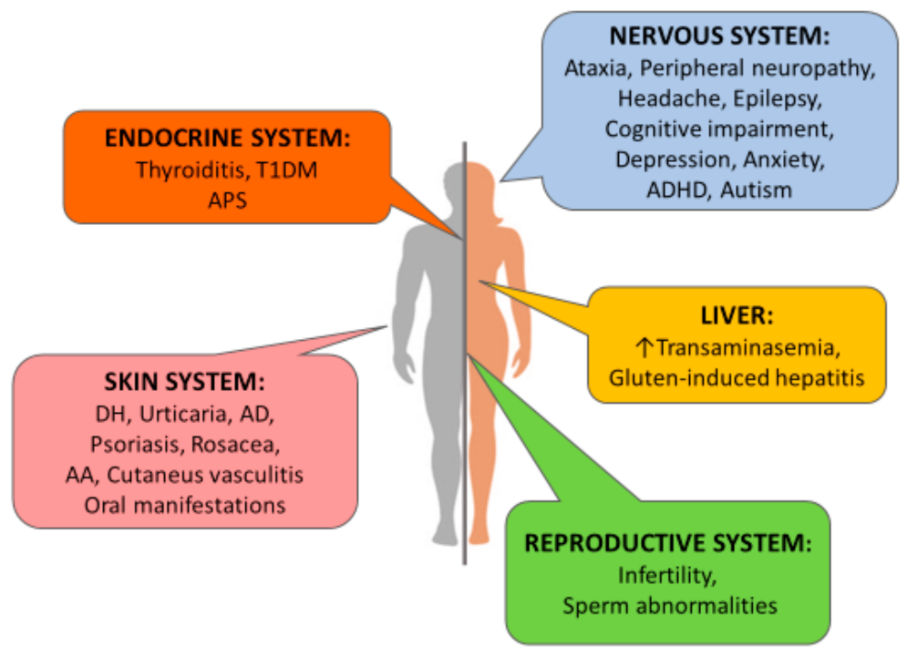 Extra Intestinal Manifestations Of Celiac Disease What Should We Know extra-intestinal-manifestations-of-celiac-disease-what-should-we-know