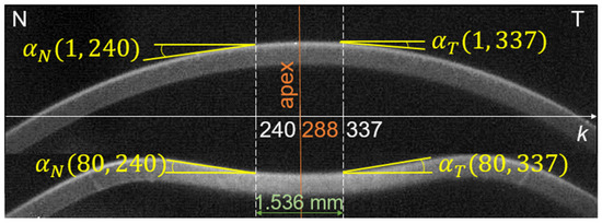 Novel Method of Measuring Corneal Viscoelasticity Using the
