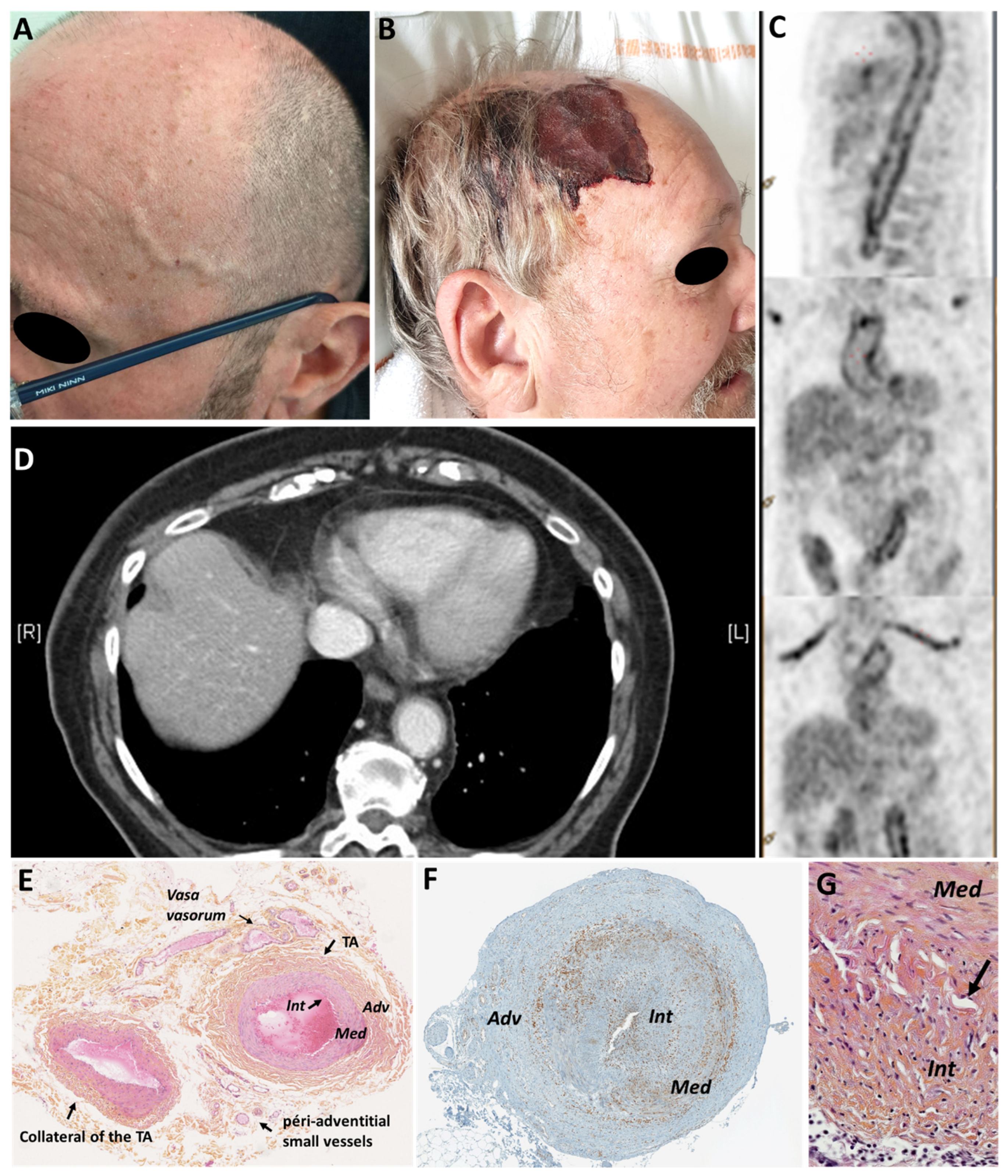 Jcm 11 00275 g001 Jcm 11 00275 g001