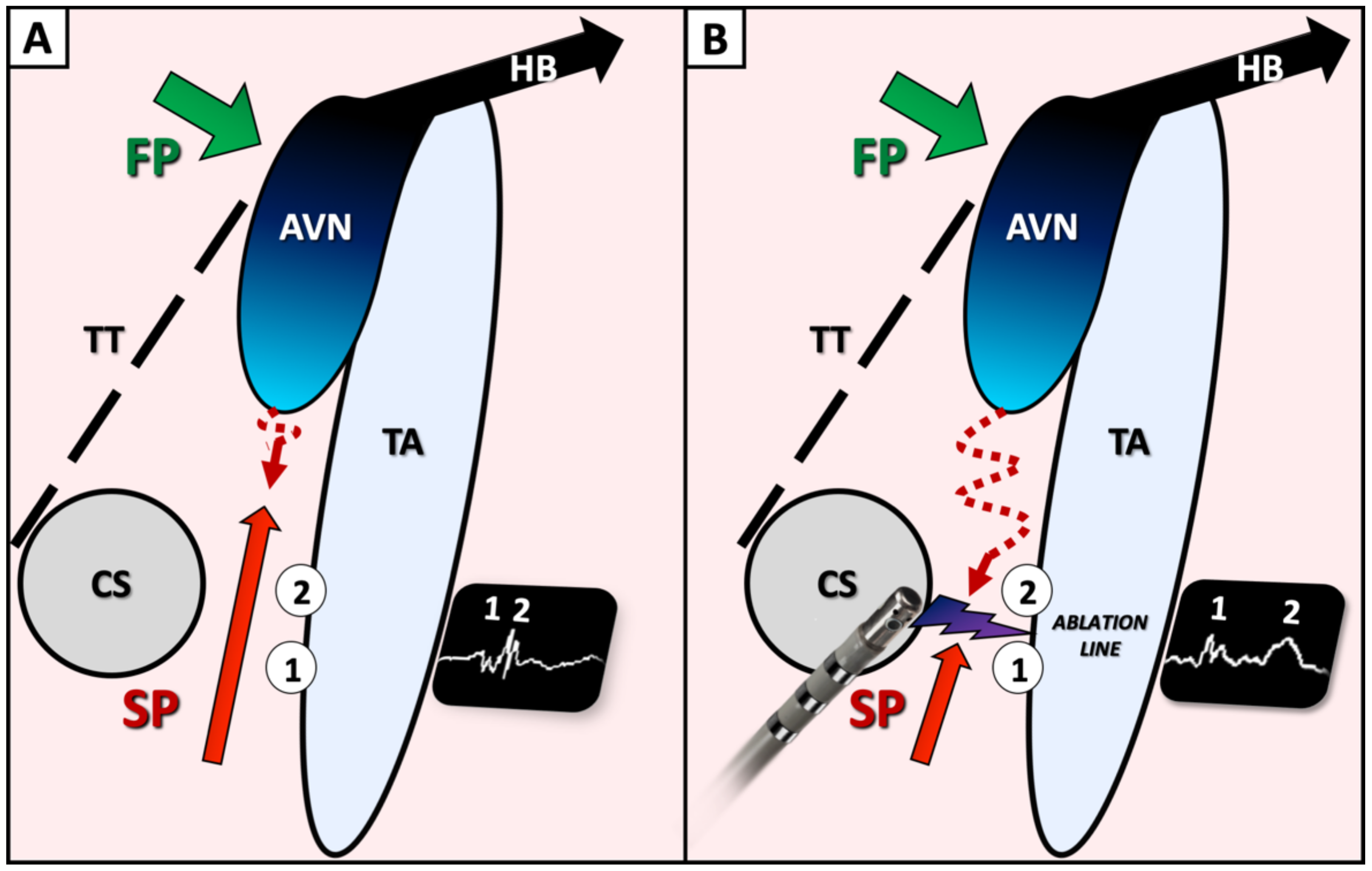 Jcm 11 00282 g005 550