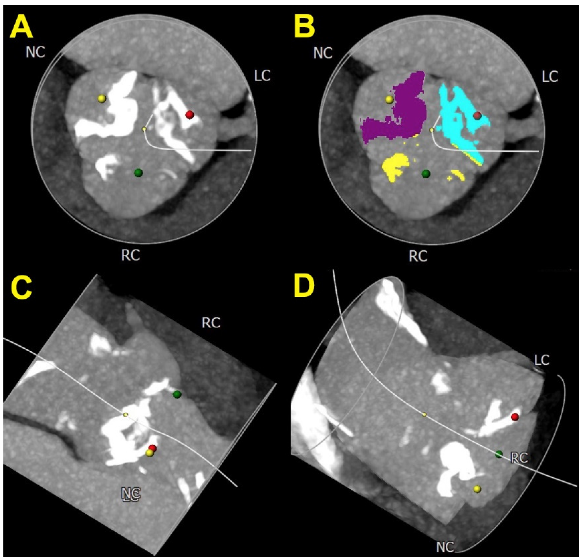 Jcm 11 00317 g003 Jcm 11 00317 g003