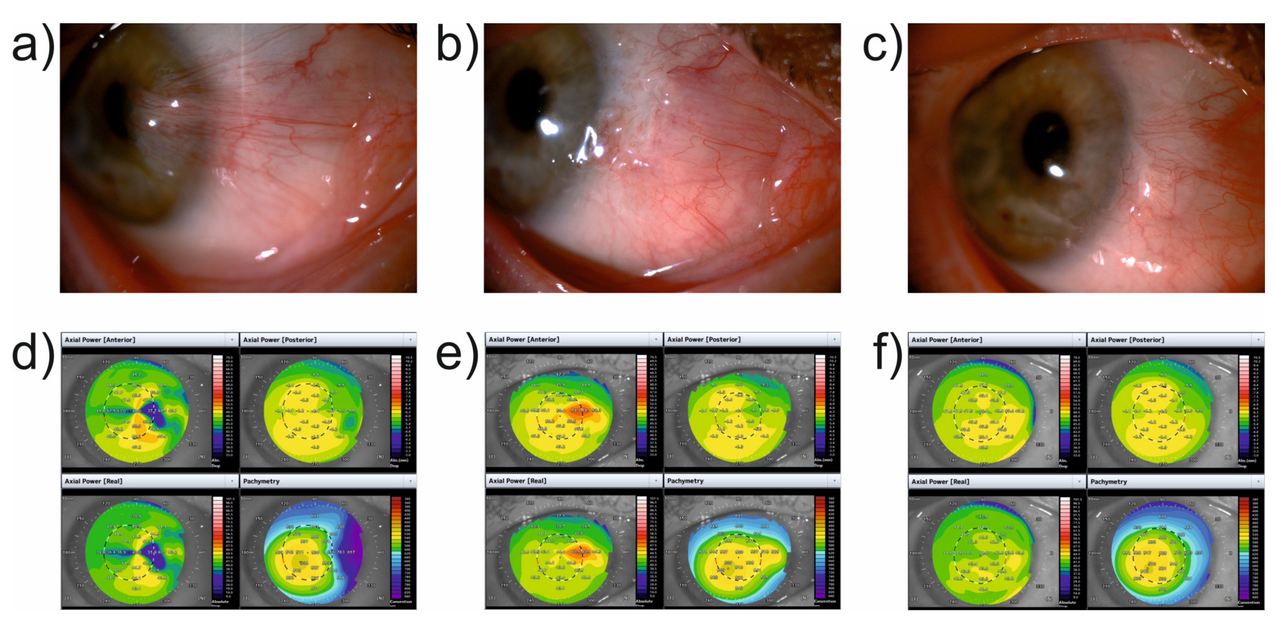 Jcm 11 00329 g002 550