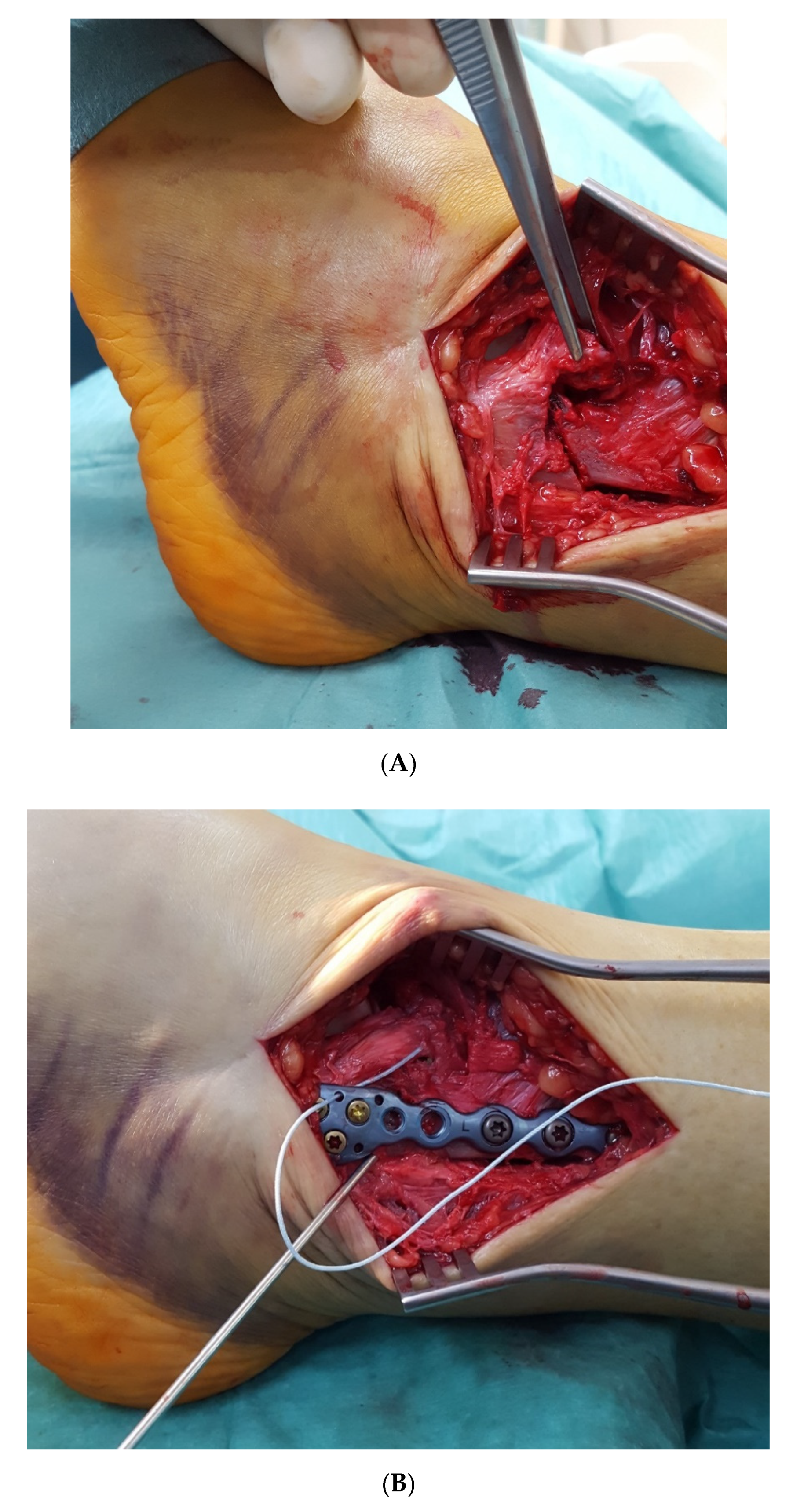 Jcm 11 00331 g003a 550