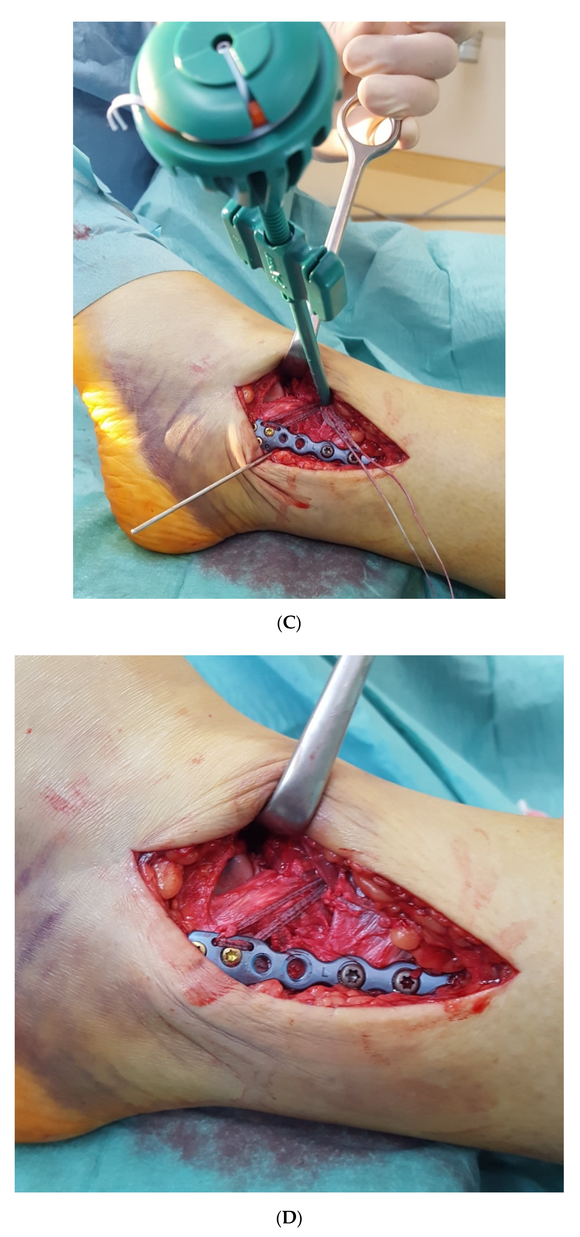 Jcm 11 00331 g003b 550