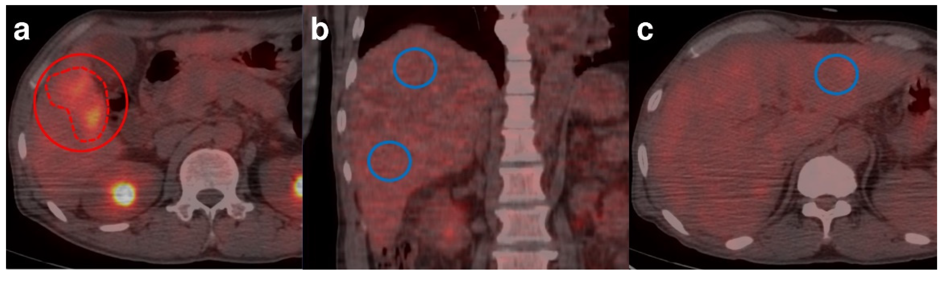 Jcm 11 00354 g002 550