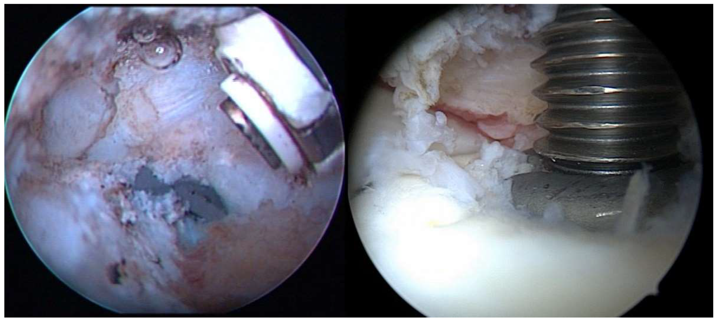 Jcm 11 00362 g002 550