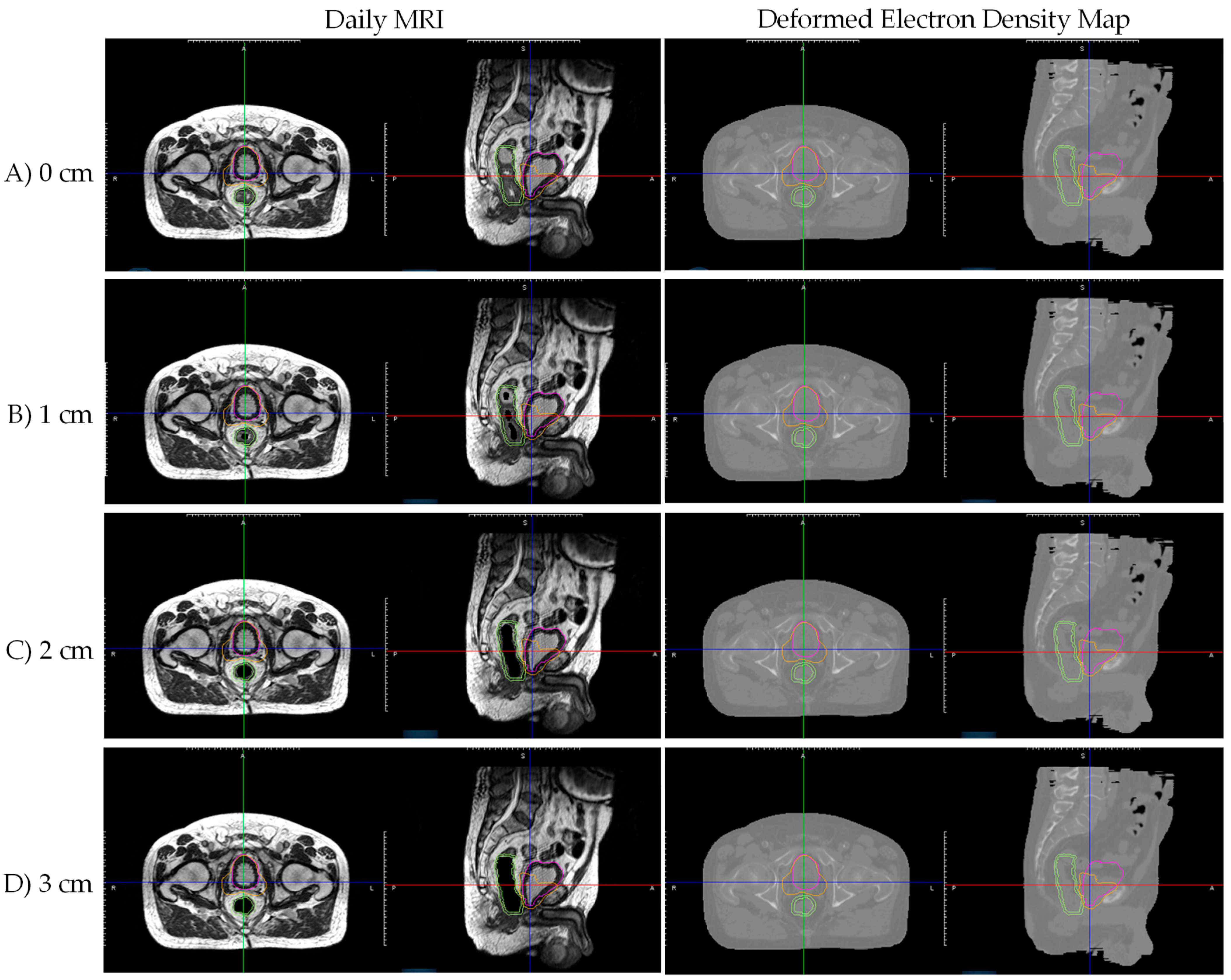 Jcm 11 00364 g002 550
