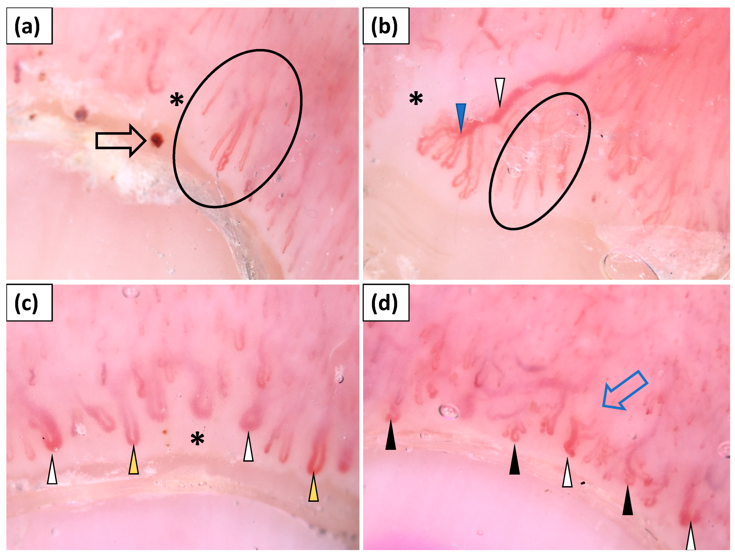 Jcm 11 00375 g001 550