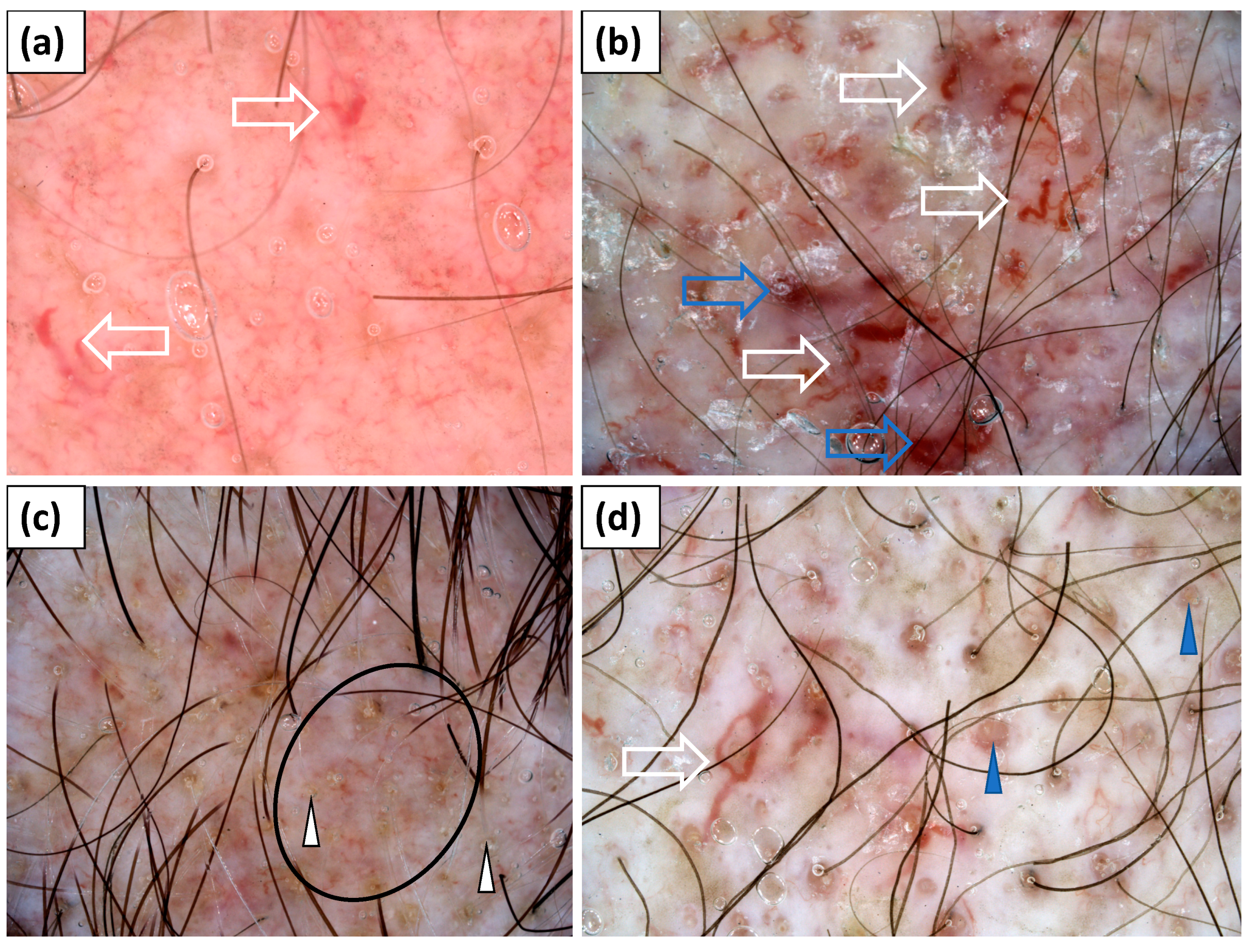 Jcm 11 00375 g002 550
