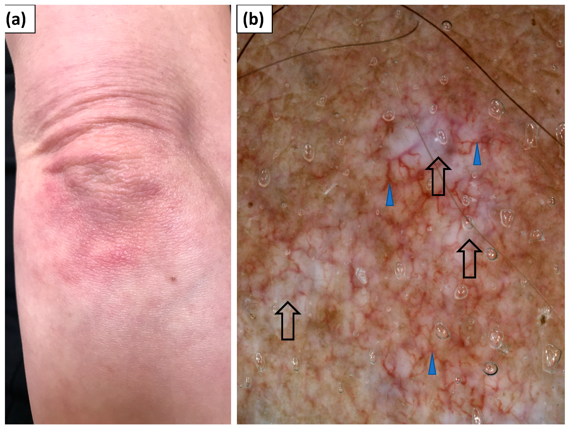 Jcm 11 00375 g004 550