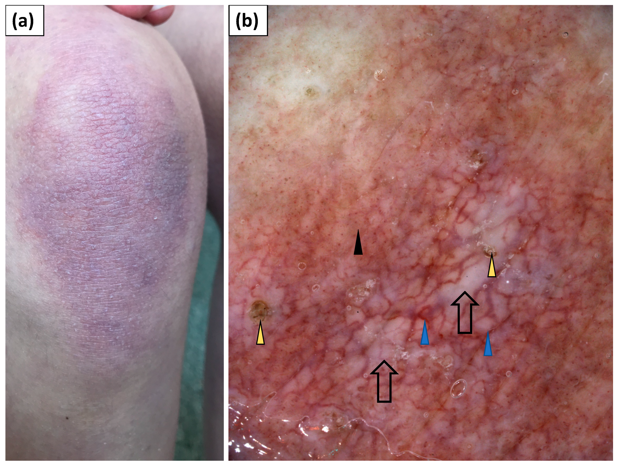 Jcm 11 00375 g005 550