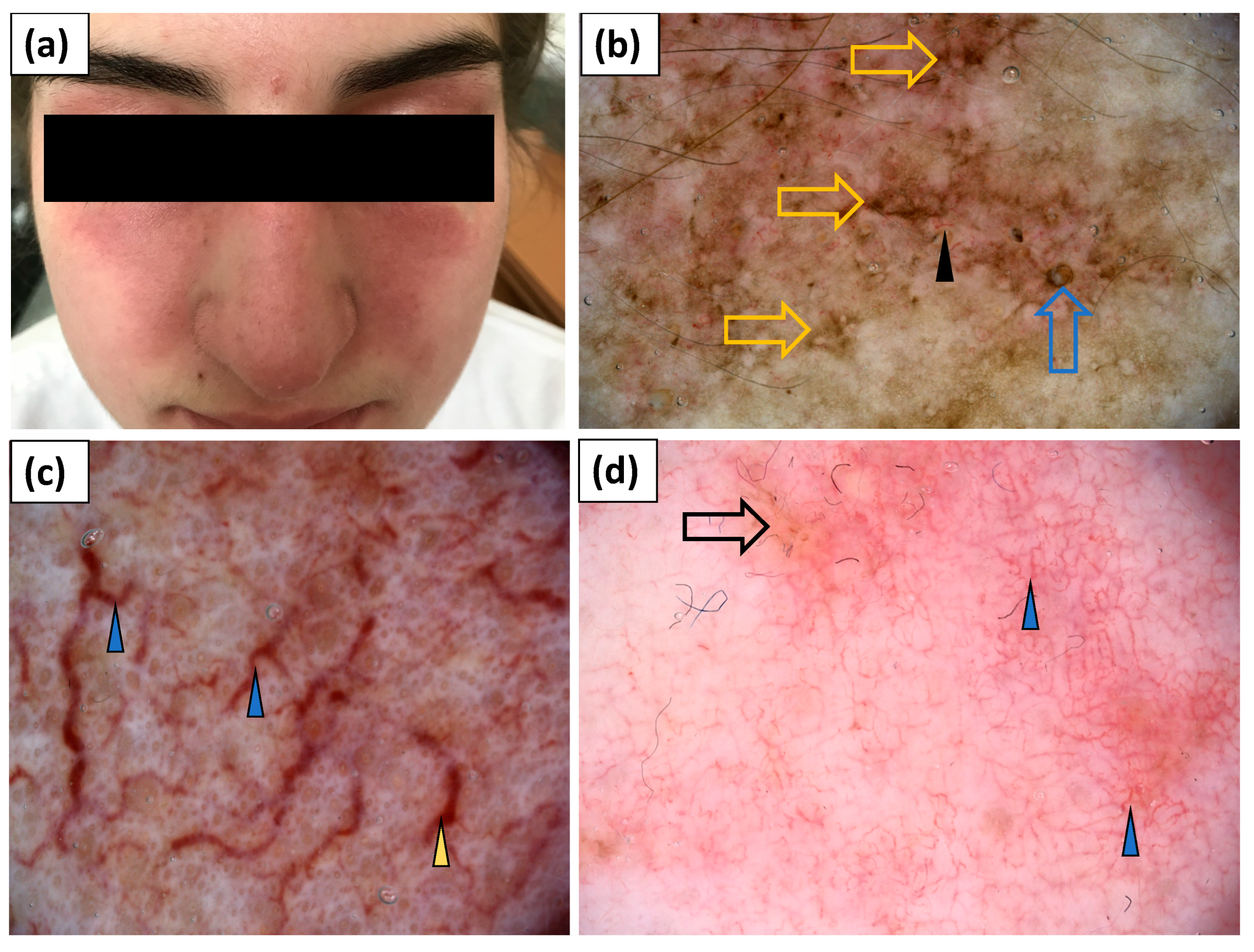 Jcm 11 00375 g007 550