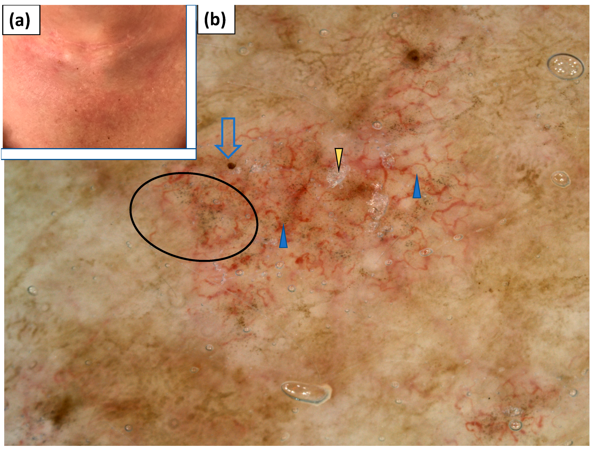 Jcm 11 00375 g008 550