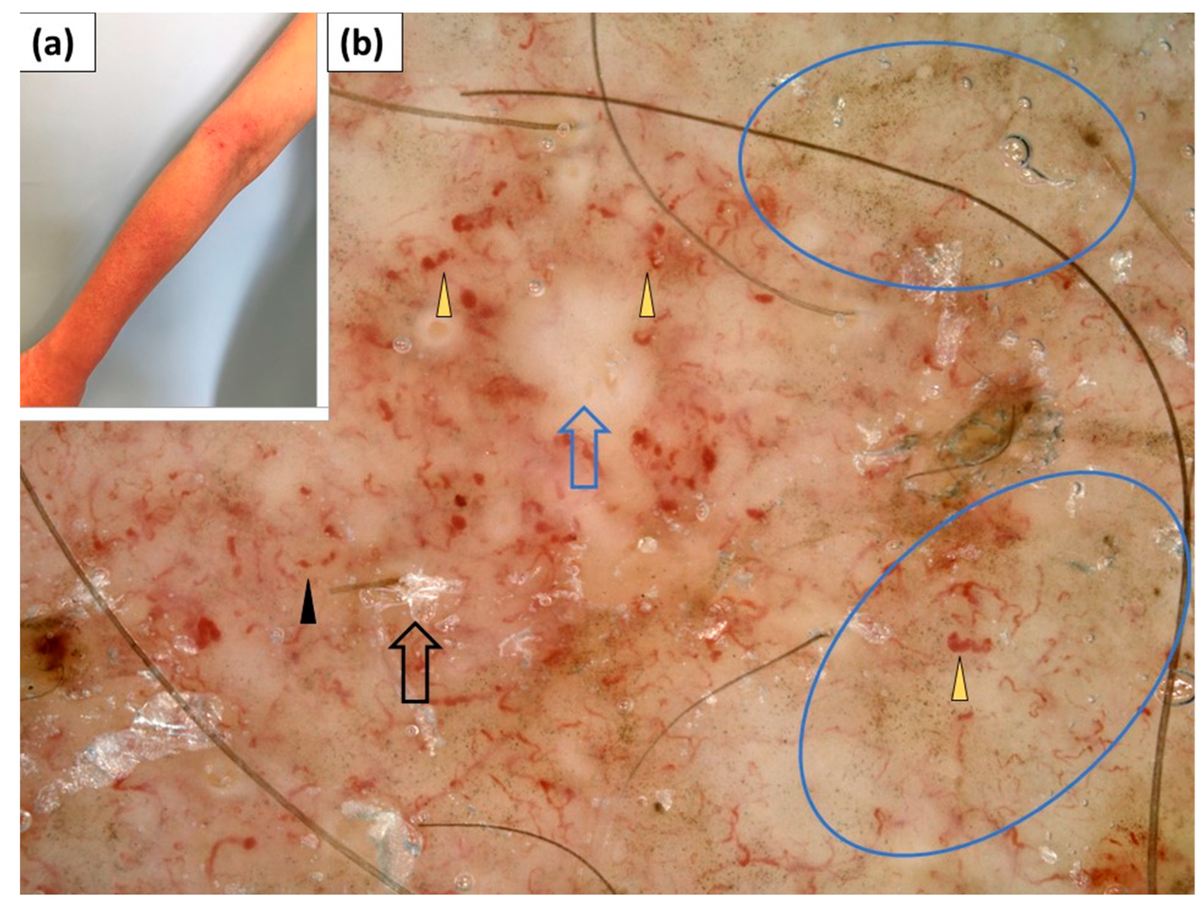 Jcm 11 00375 g010 550