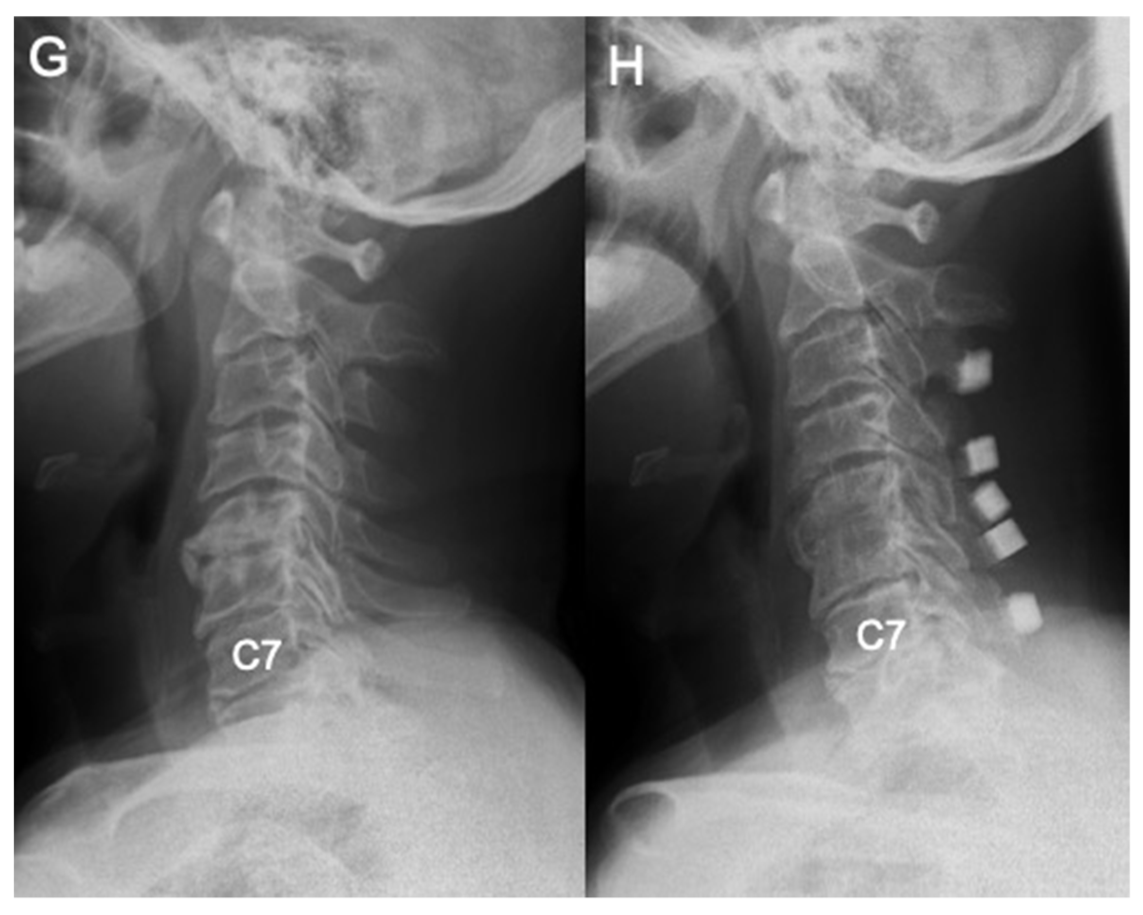 Jcm 11 00411 g005b 550