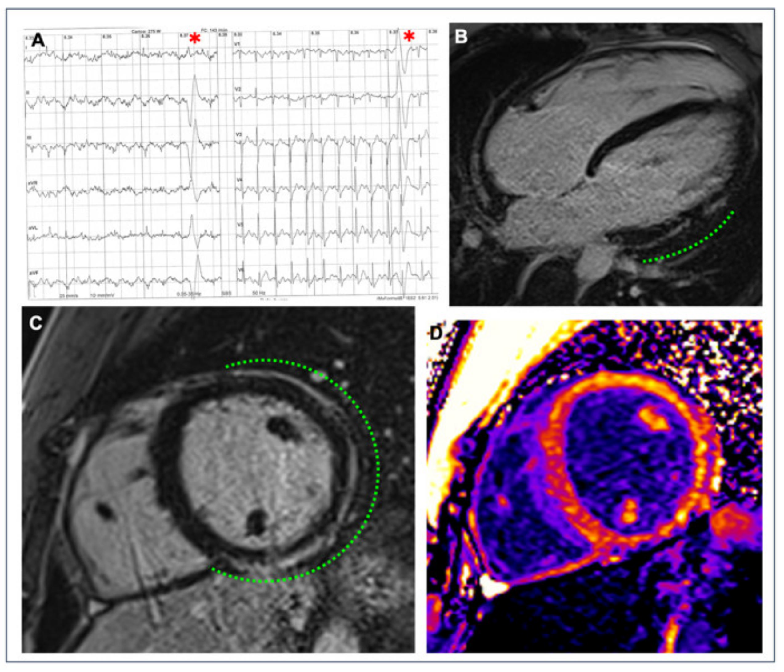 Jcm 11 00426 g002 Jcm 11 00426 g002