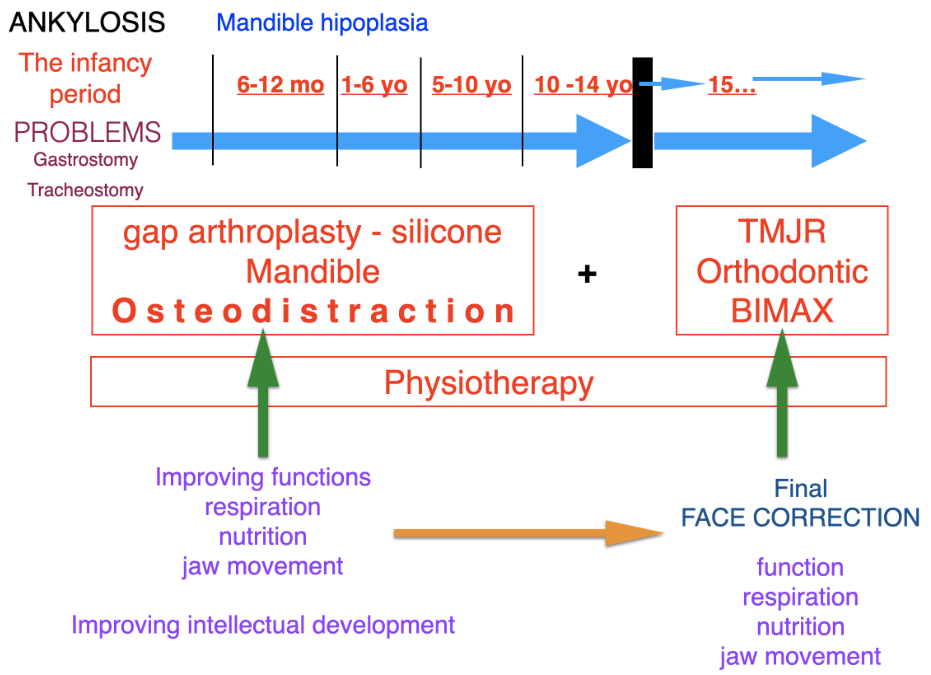 JCM Free Full-Text Protocol for Multi-Stage Treatment of Temporomandibular Joint Ankylosis in Children and Adolescents