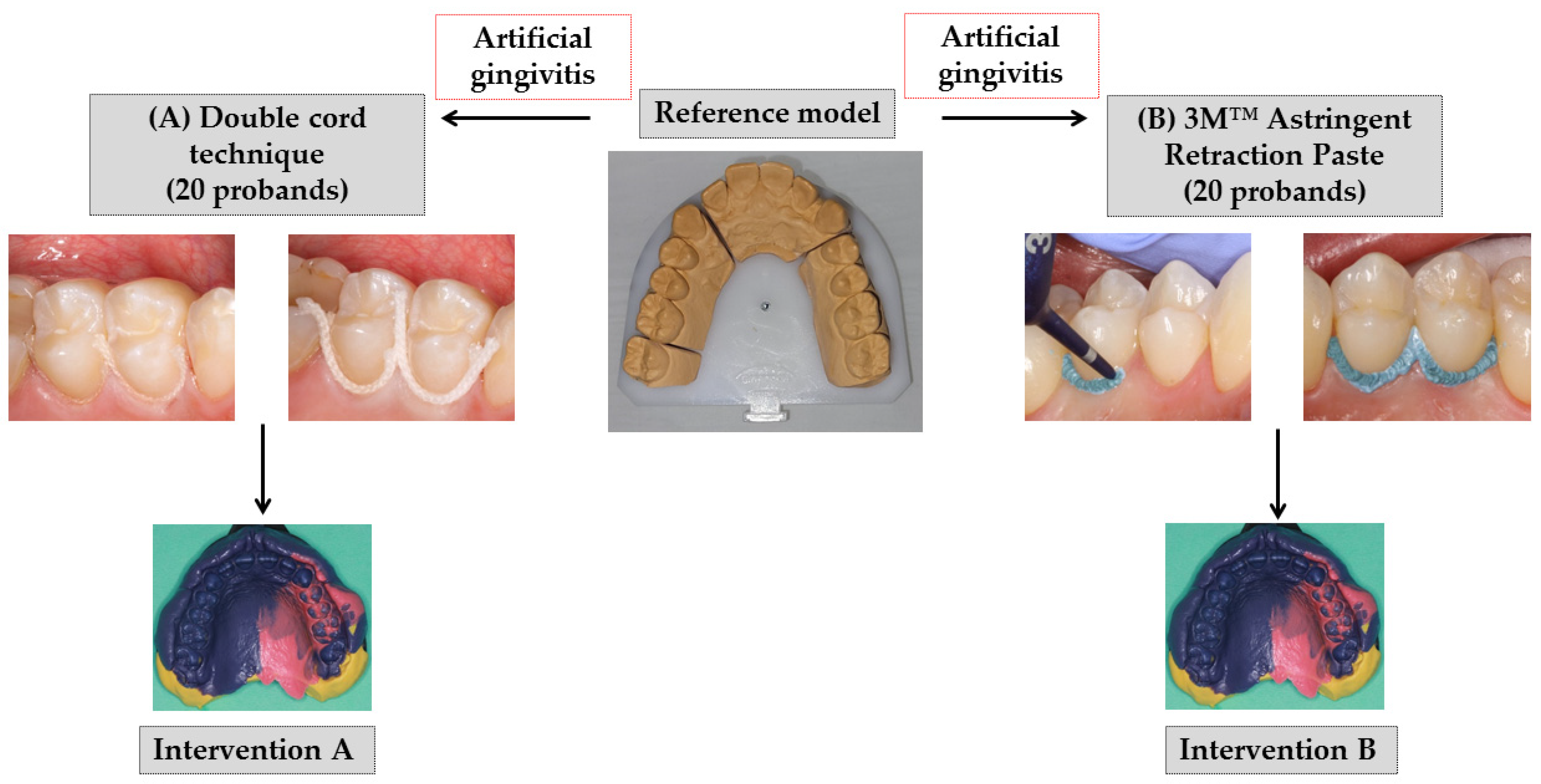 JCM Free FullText Gingival Displacement in the Vertical and