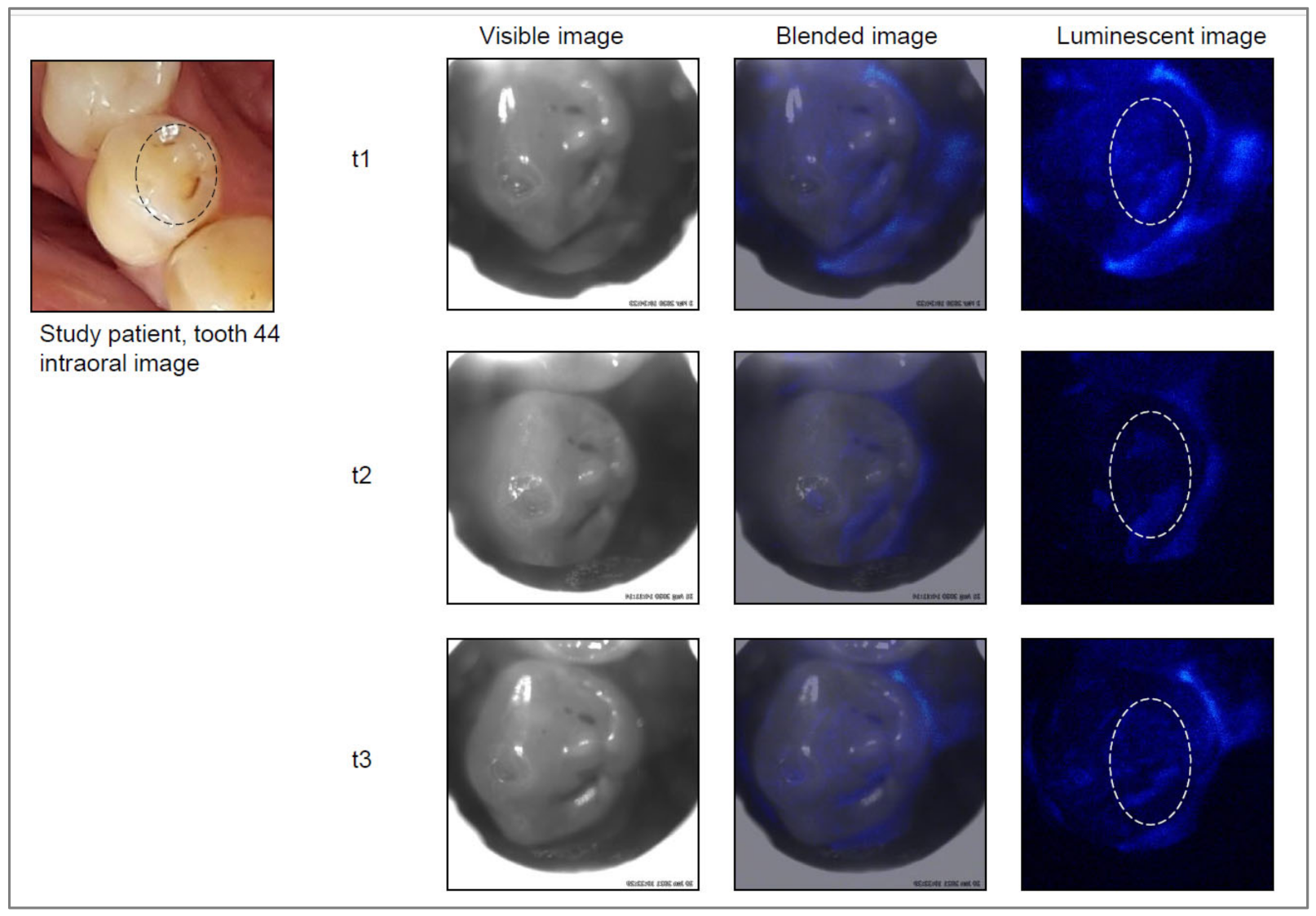 Jcm 11 00464 g002 550
