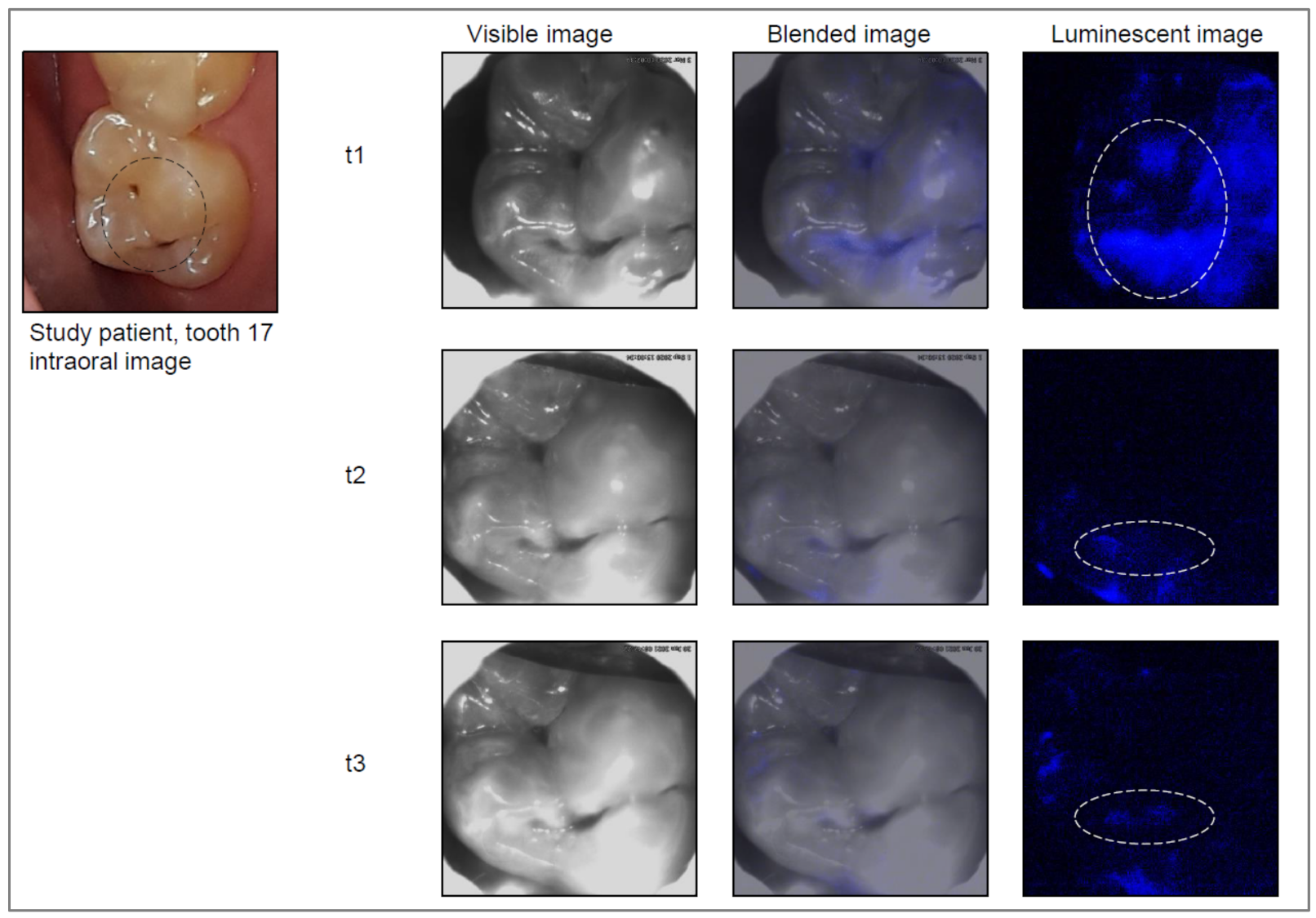 Jcm 11 00464 g003 550