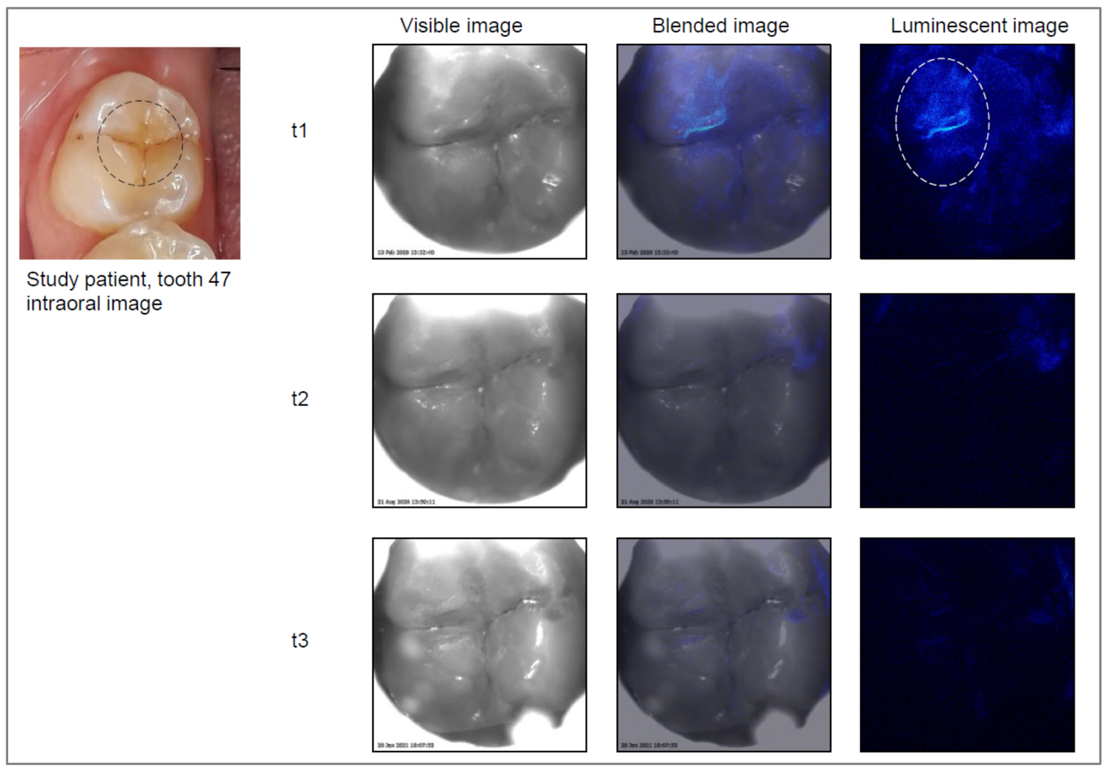 Jcm 11 00464 g004 550