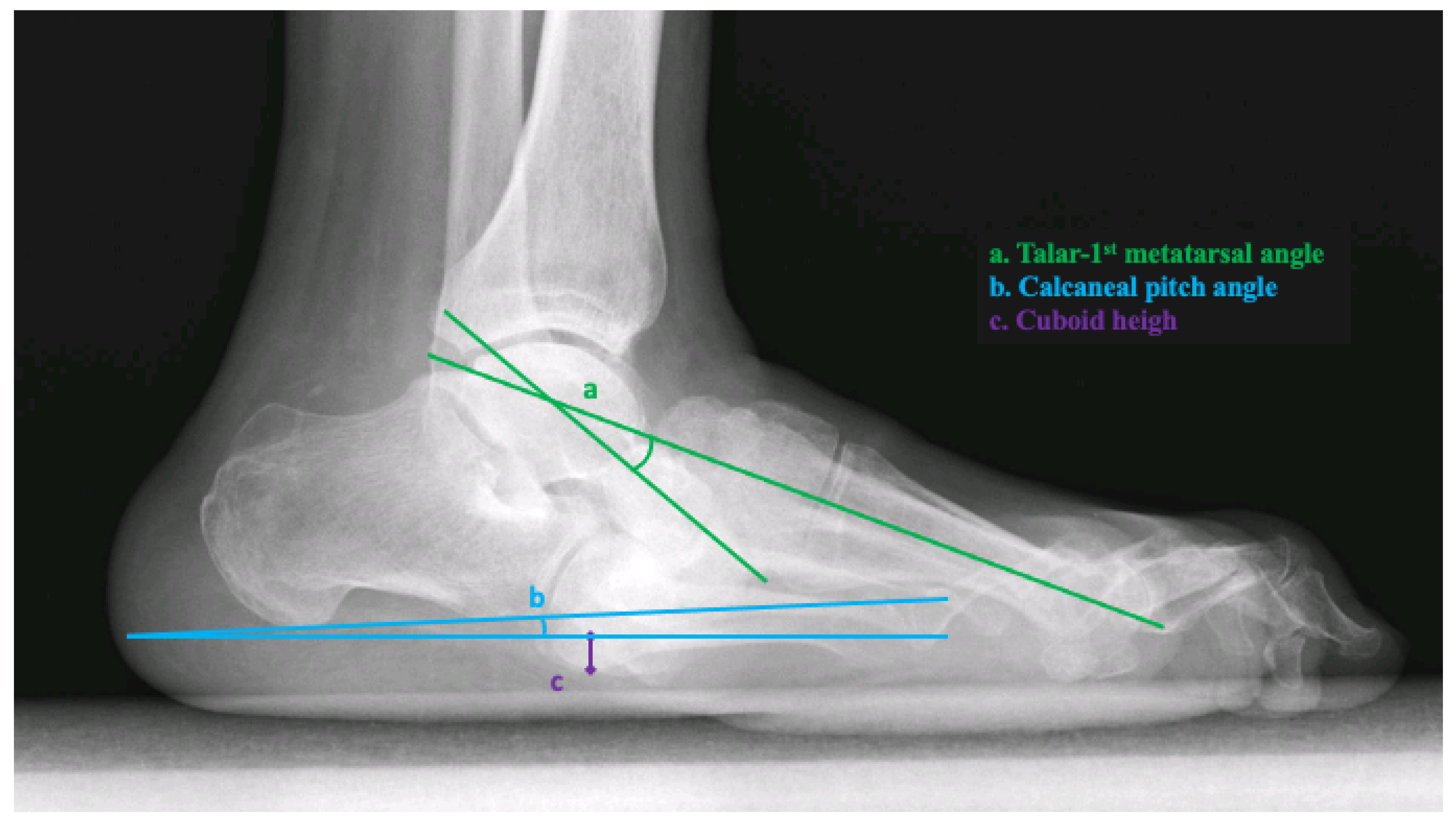 Jcm 11 00474 g001 550