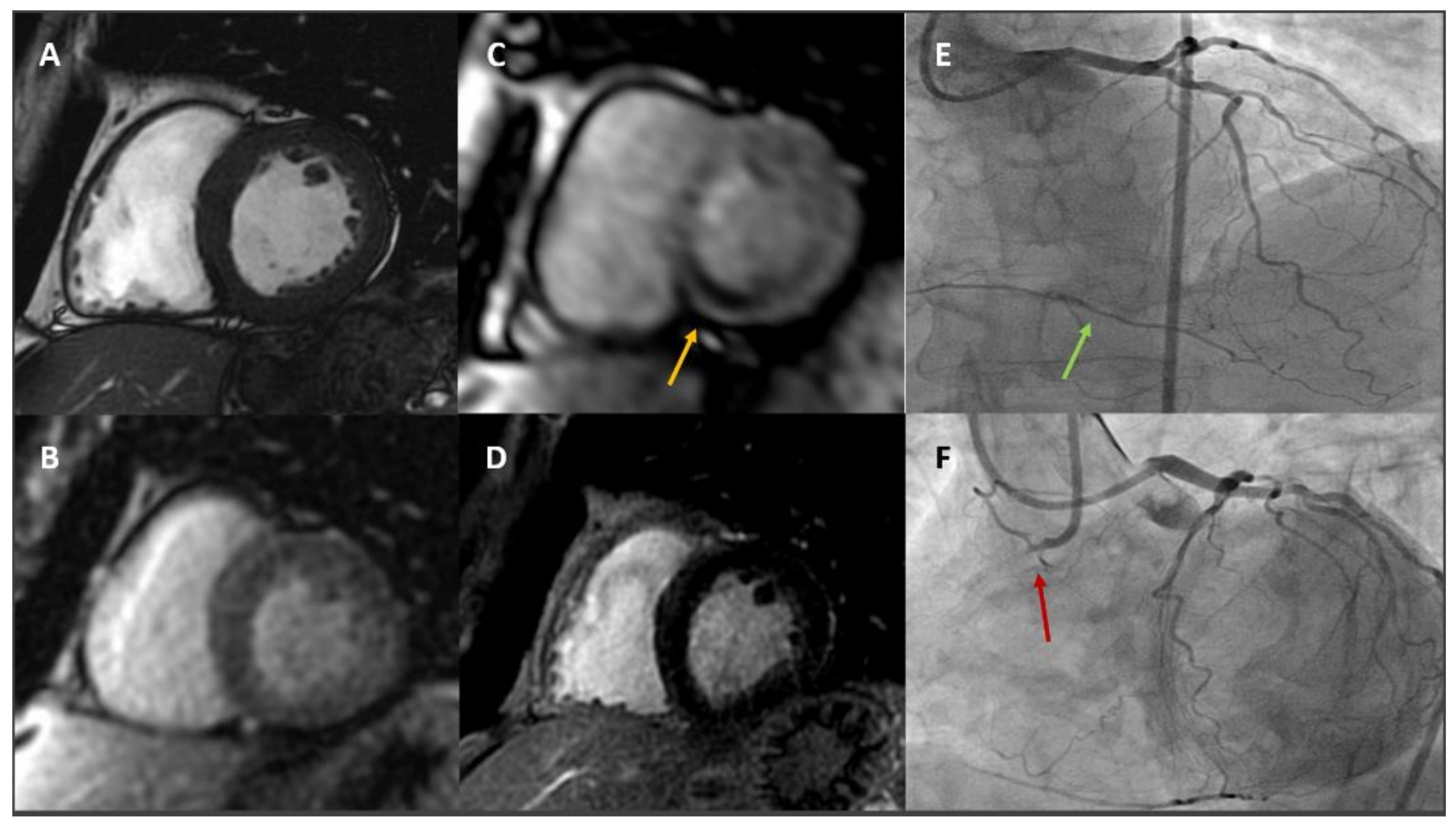 Jcm 11 00477 g002 550