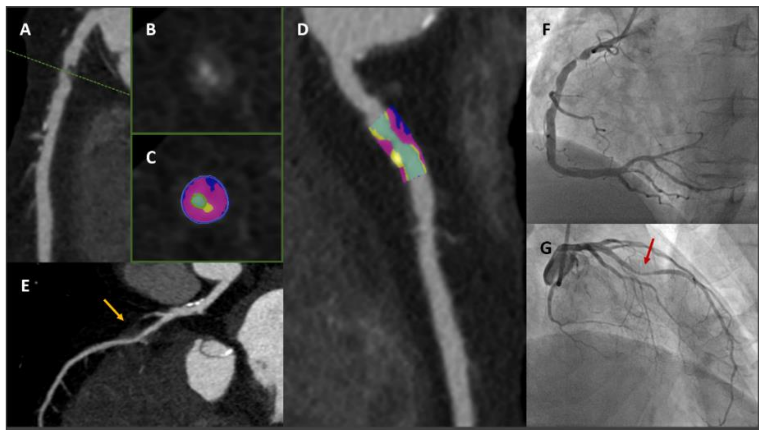 Jcm 11 00477 g003 550