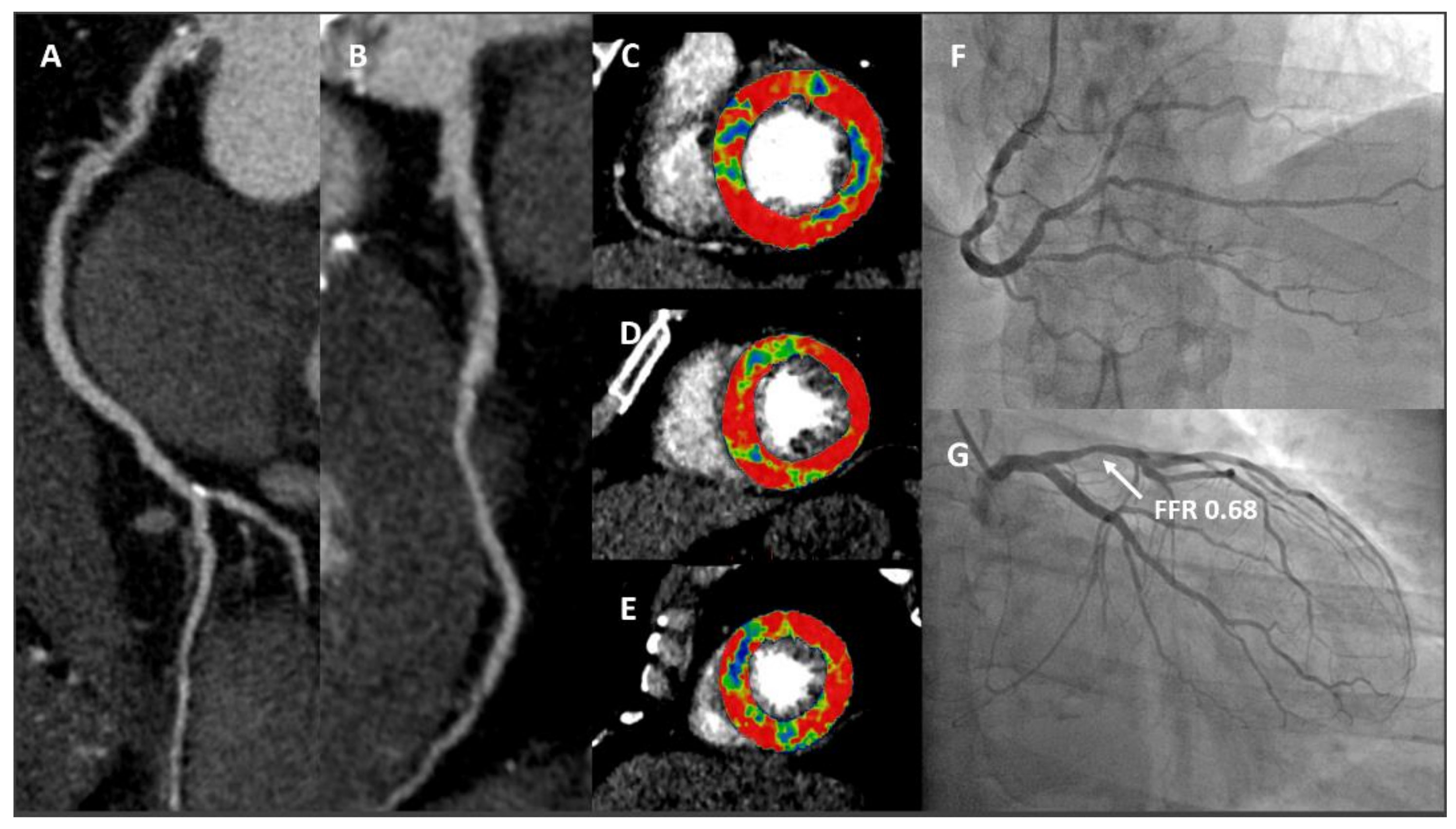 Jcm 11 00477 g005 550