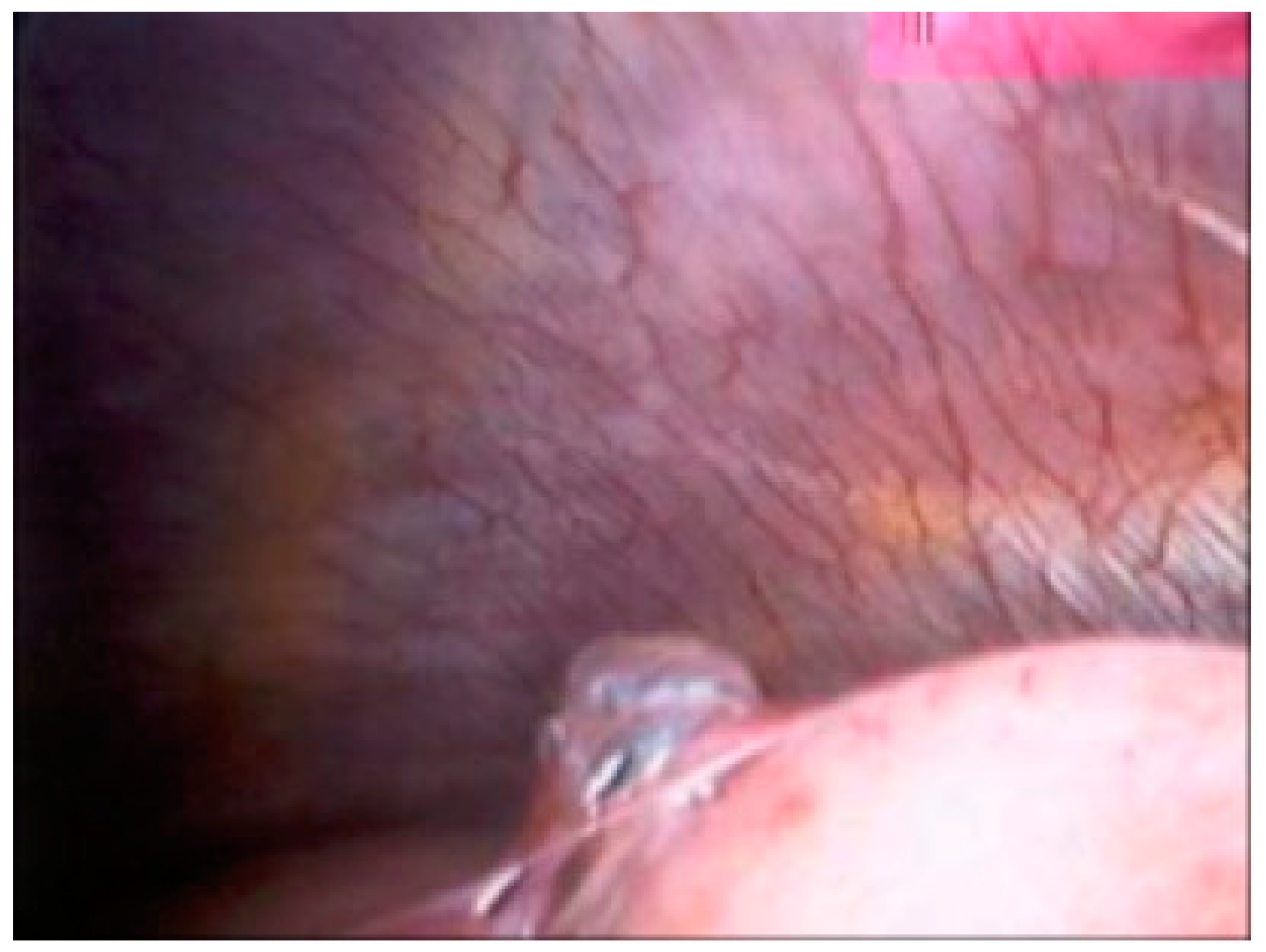 Jcm 11 00490 g003 Jcm 11 00490 g003