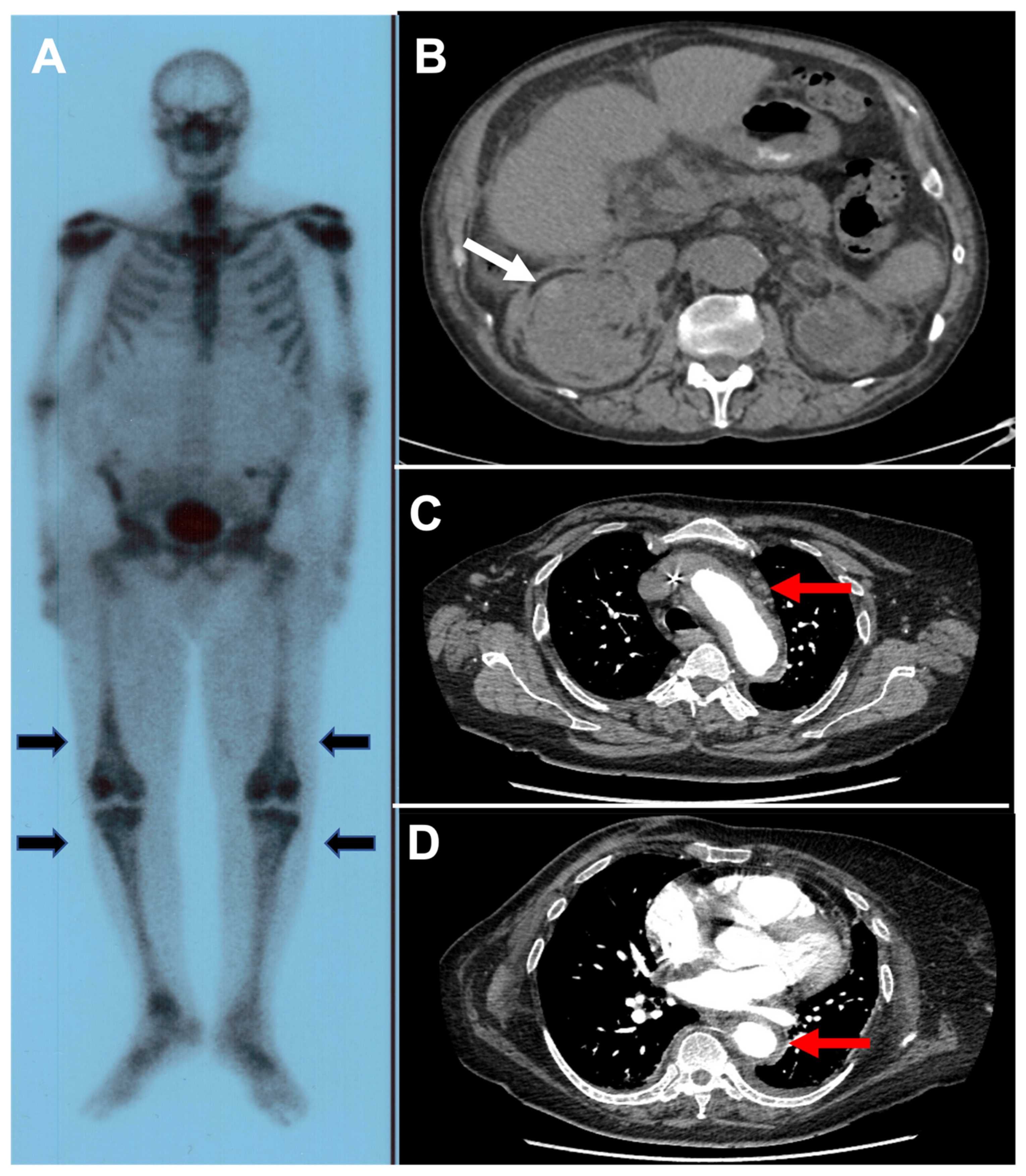 Jcm 11 00495 g002 550