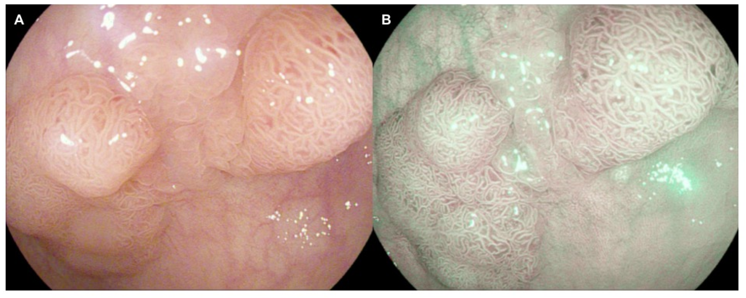 Jcm 11 00509 g002 Jcm 11 00509 g002