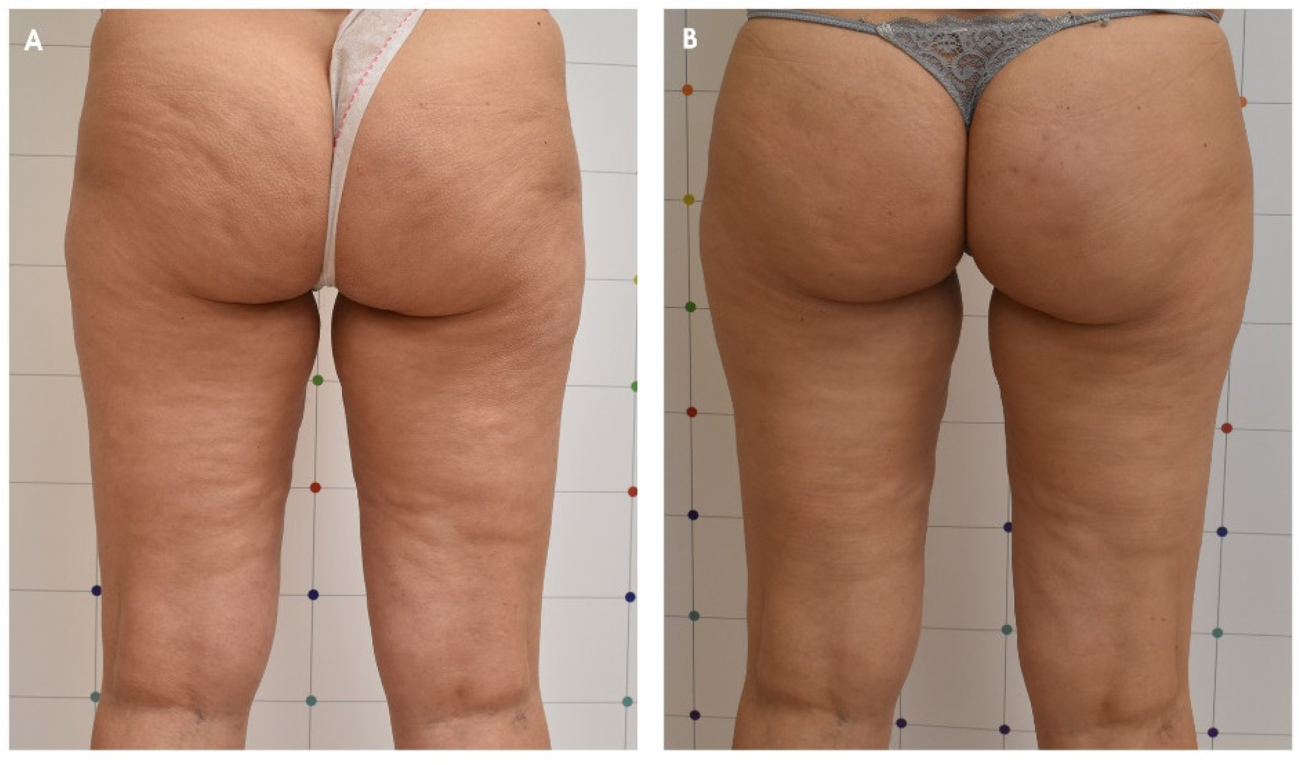 Jcm 11 00515 g003 550