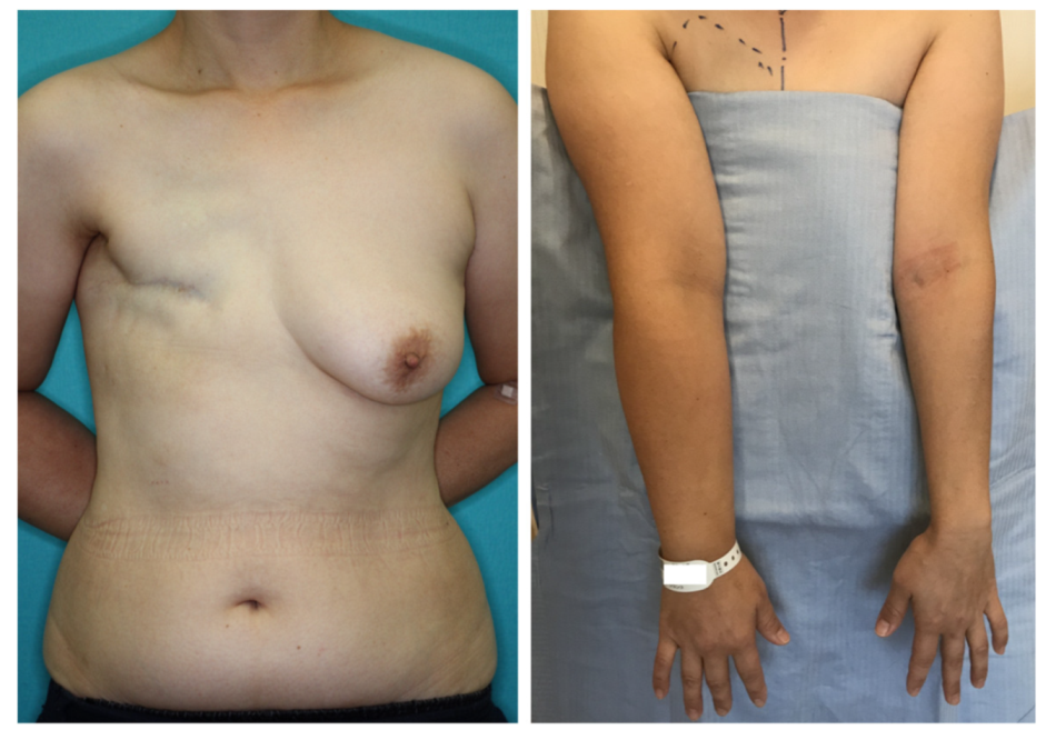 Jcm 11 00534 g001 550