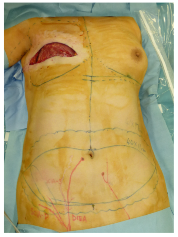 Jcm 11 00534 g002 550