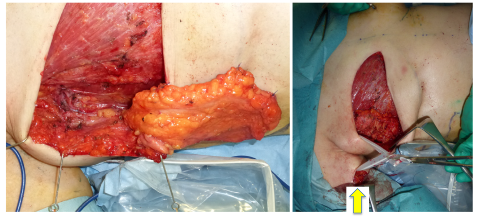 Jcm 11 00534 g004 550