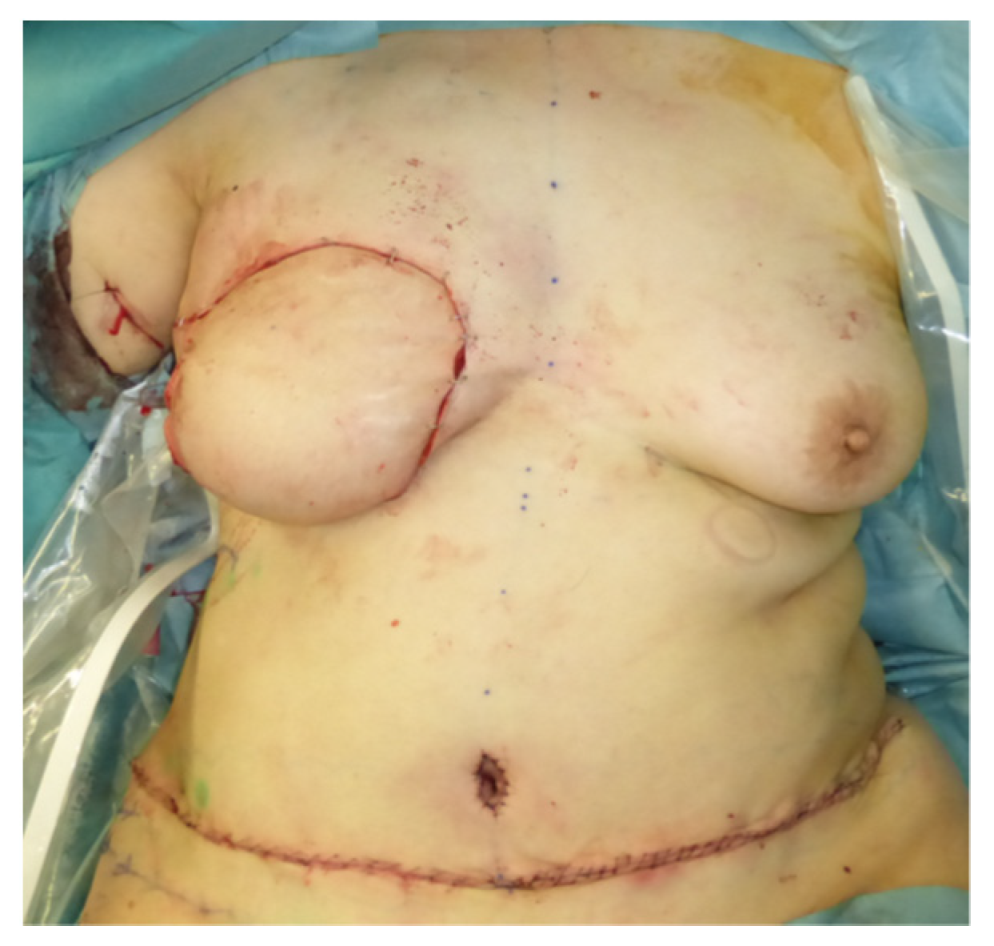 Jcm 11 00534 g005 550