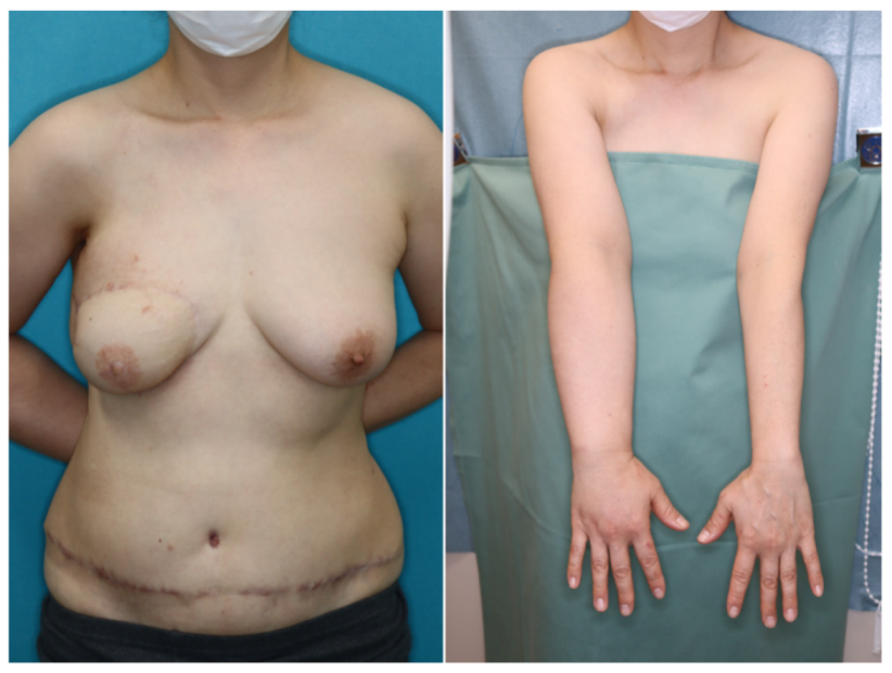 Jcm 11 00534 g006 550