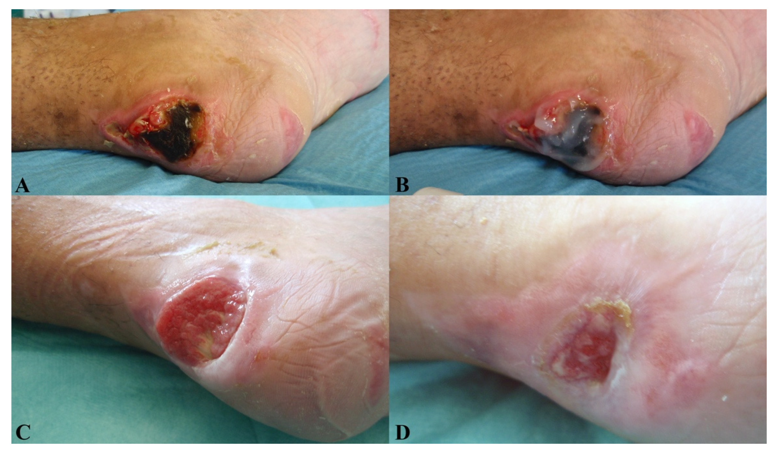 Jcm 11 00537 g007 Jcm 11 00537 g007