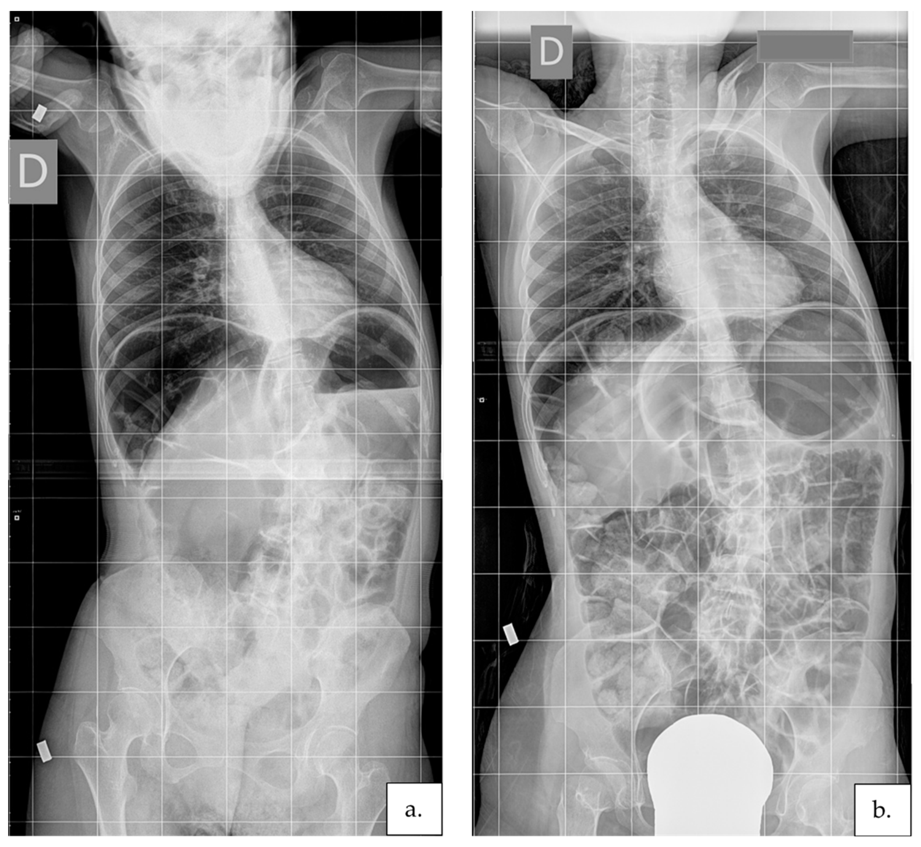 Jcm 11 00559 g004 550
