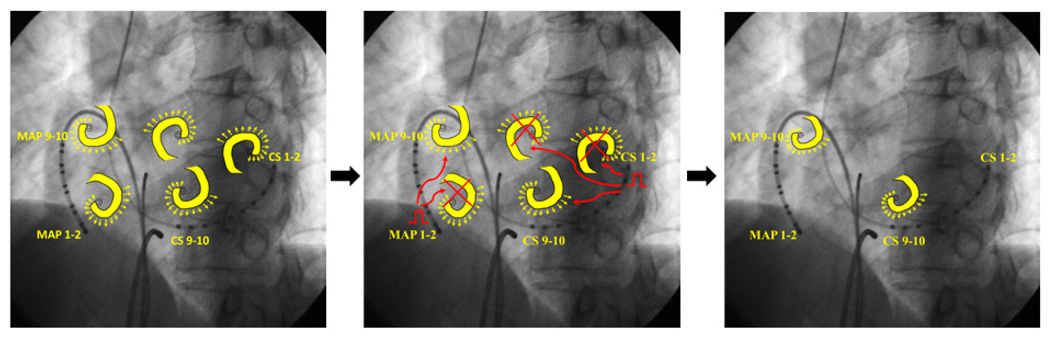 Jcm 11 00575 g009 550