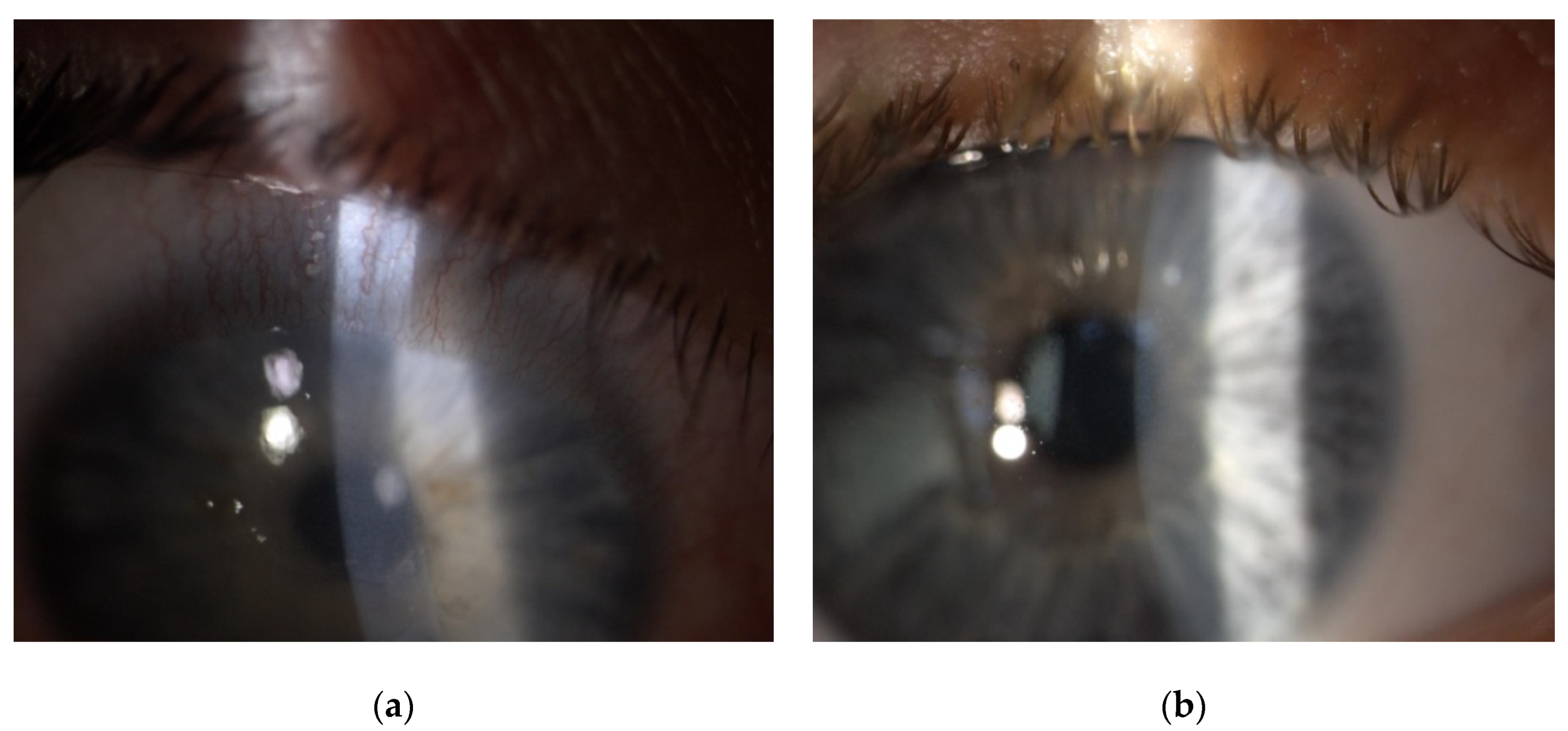 Jcm 11 00585 g001 Jcm 11 00585 g001