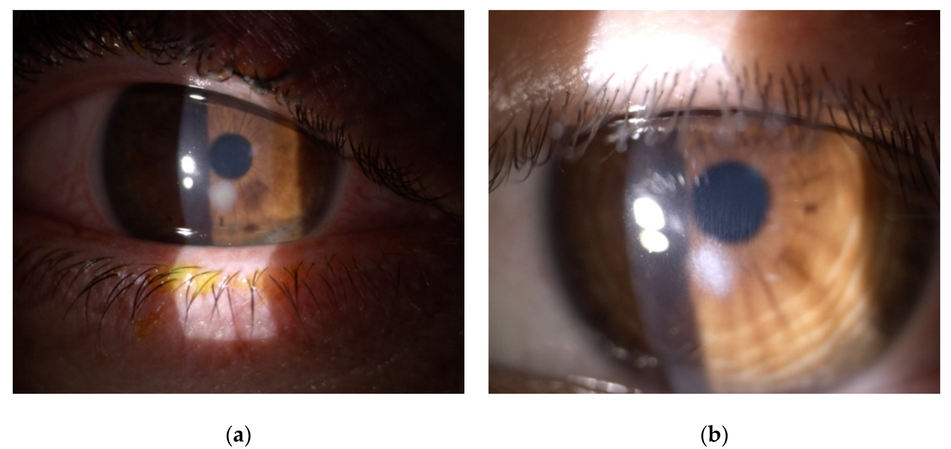 Jcm 11 00585 g002 Jcm 11 00585 g002