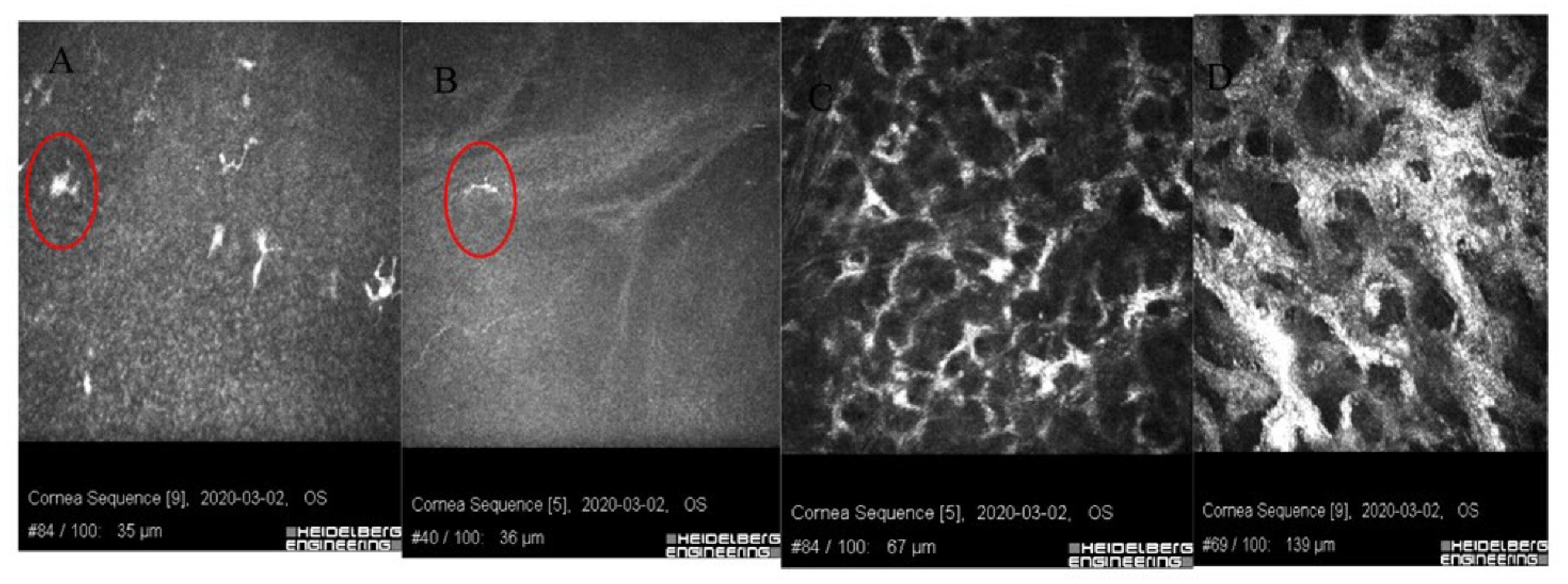 Jcm 11 00585 g004 Jcm 11 00585 g004