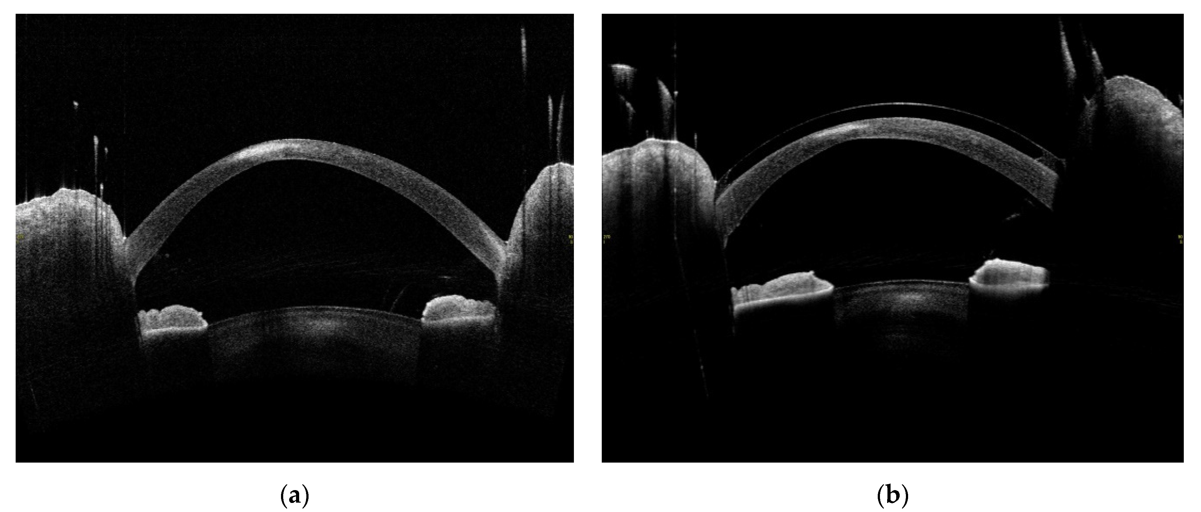 Jcm 11 00585 g007 Jcm 11 00585 g007